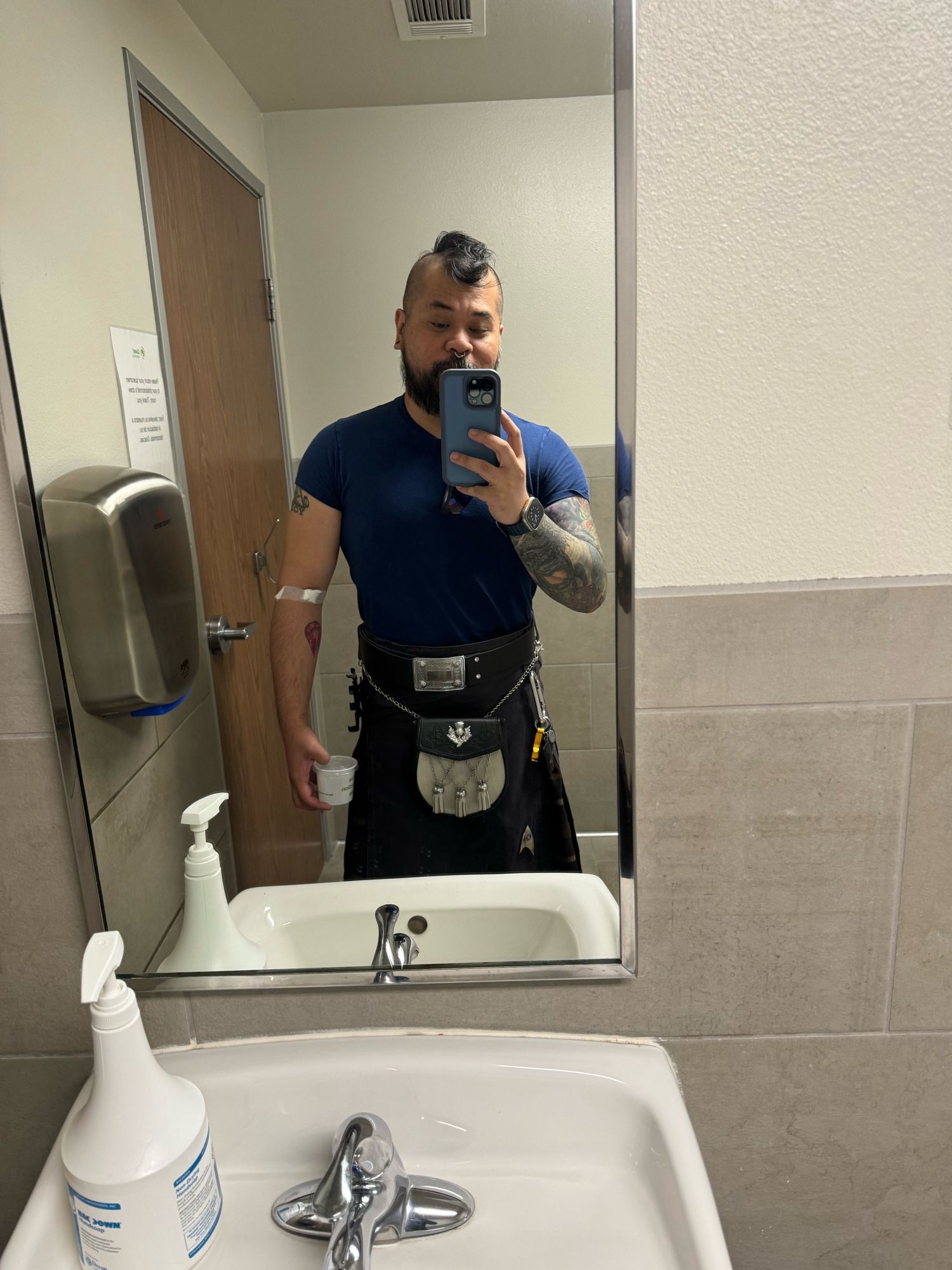 Leon in a laboratory restroom holding a pee cup, with gauze taped to his antecubit.