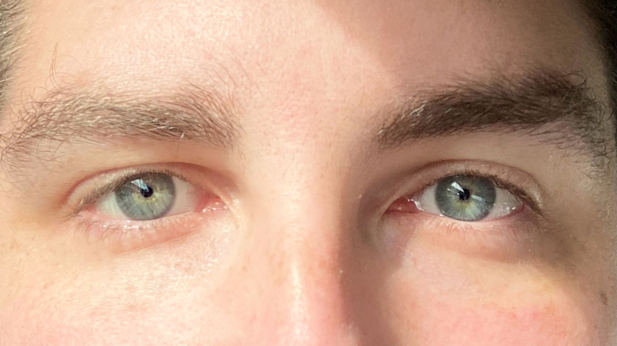 My eyes in the sunlight, blueish greyish greenish with gold rings in the middle