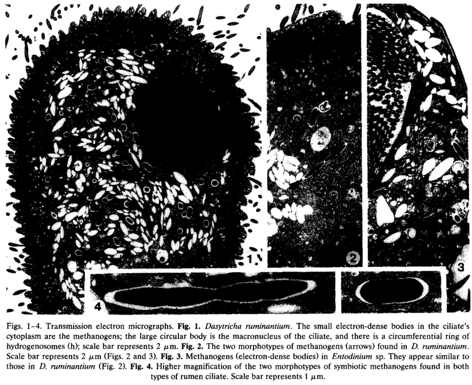 Figures 1-4 from Finlay et al. 1994, Microbiology Letters 117(2): 157-161. Caption: Transmission electron micrographs. Figure 1: Dasytricha ruminantium. The small electron-dense bodies in the ciliate's cytoplasm are the methanogens; the large circular body is the macronucleus of the ciliate, and there is a circumferential ring of hydrogenosomes; scale bar represents 2 micrometers. Figure 2. The two morphotypes of methanogens found in D. ruminantium. Scale bar represents 2 micrometers. Figure 3. Methanogens (electron-dense bodies) in Entodinium species. They appear similar to those in D. ruminantium. Figure 4. Higher magnification of the two morphotypes of symbiotic methanogens found in both types of rumen ciliate. Scale bar represents 1 micrometer.