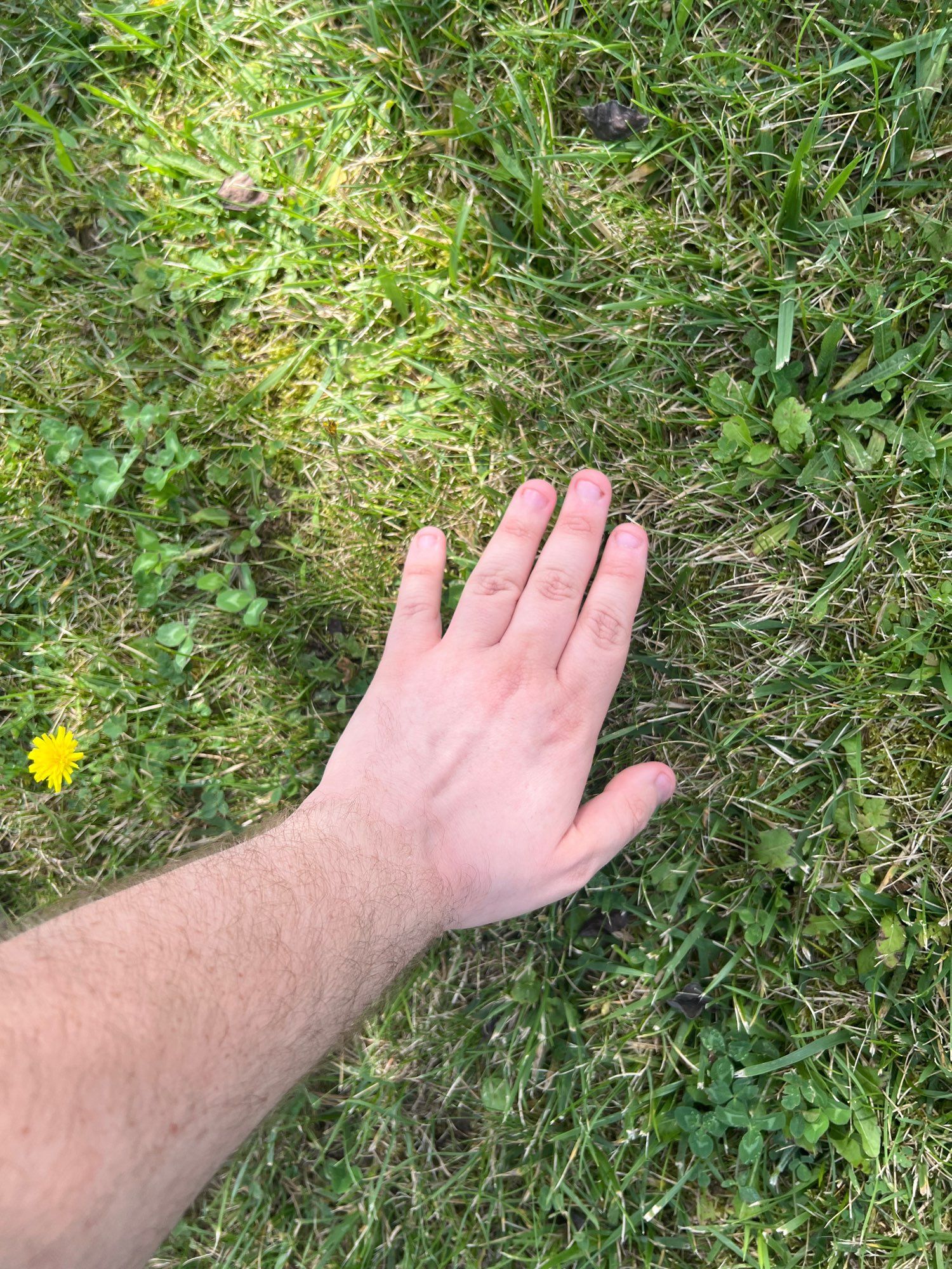 A picture of my hand touching grass with a yellow dandelion to the left