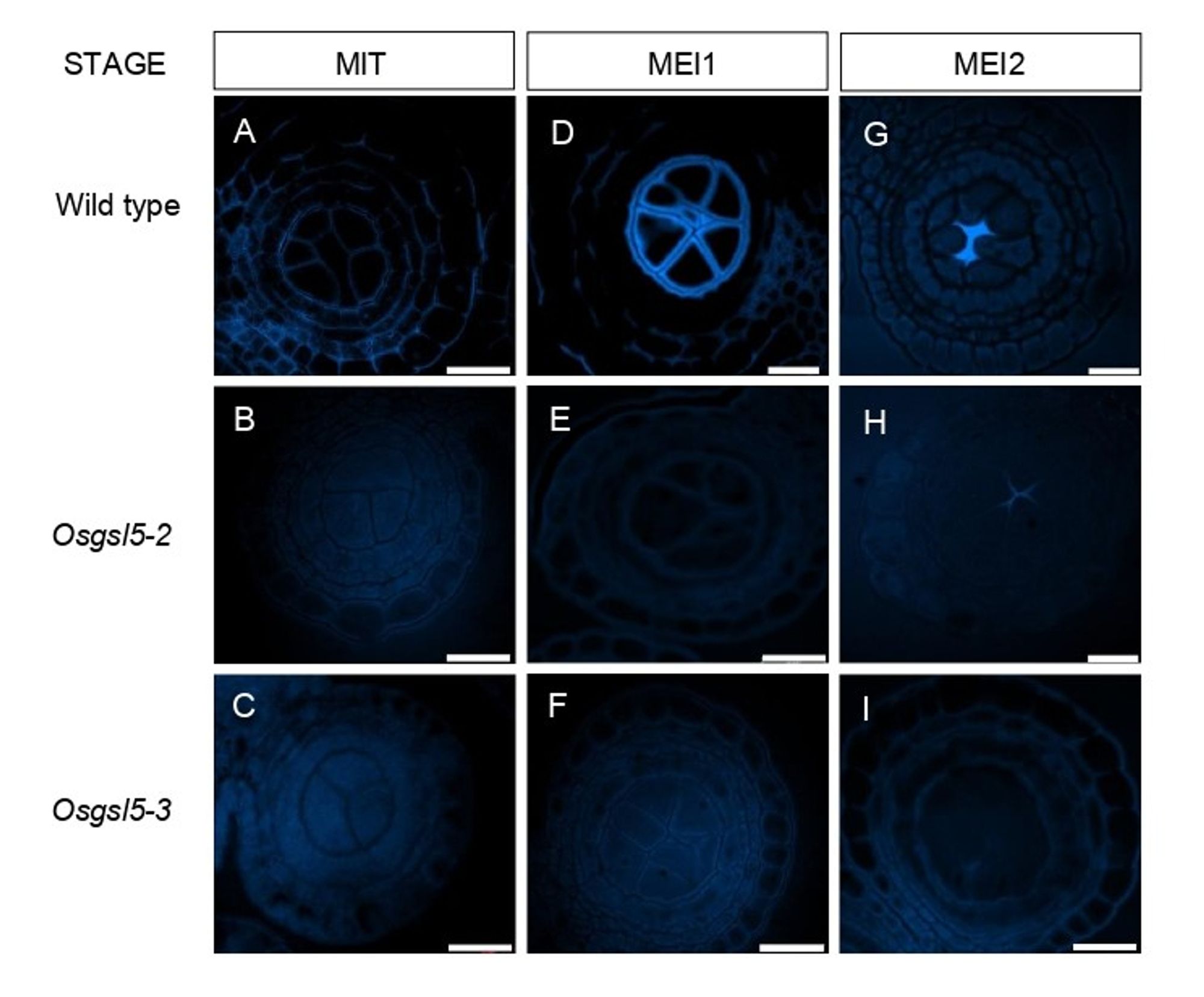 Figure with nine panels showing callose deposition in rice anthers during the transition from mitosis to meiosis. In wild-type (WT) plants and two mutant lines, Osgsl5-2 and Osgsl5-3, callose is not found in the anther chambers during the early mitotic stage (anther length ≤ 0.35 mm) (A, D, G). As the cells prepare for meiosis (anther length 0.35-0.45 mm), callose begins to form around the pollen mother cells in WT plants but is absent in the mutants (B, E, H). By early meiotic stages (anther length 0.5-0.55 mm), WT plants show callose accumulation at the center of the anther chamber, while little to no callose appears in the mutants (C, F, I). Scale bar = 20μm.