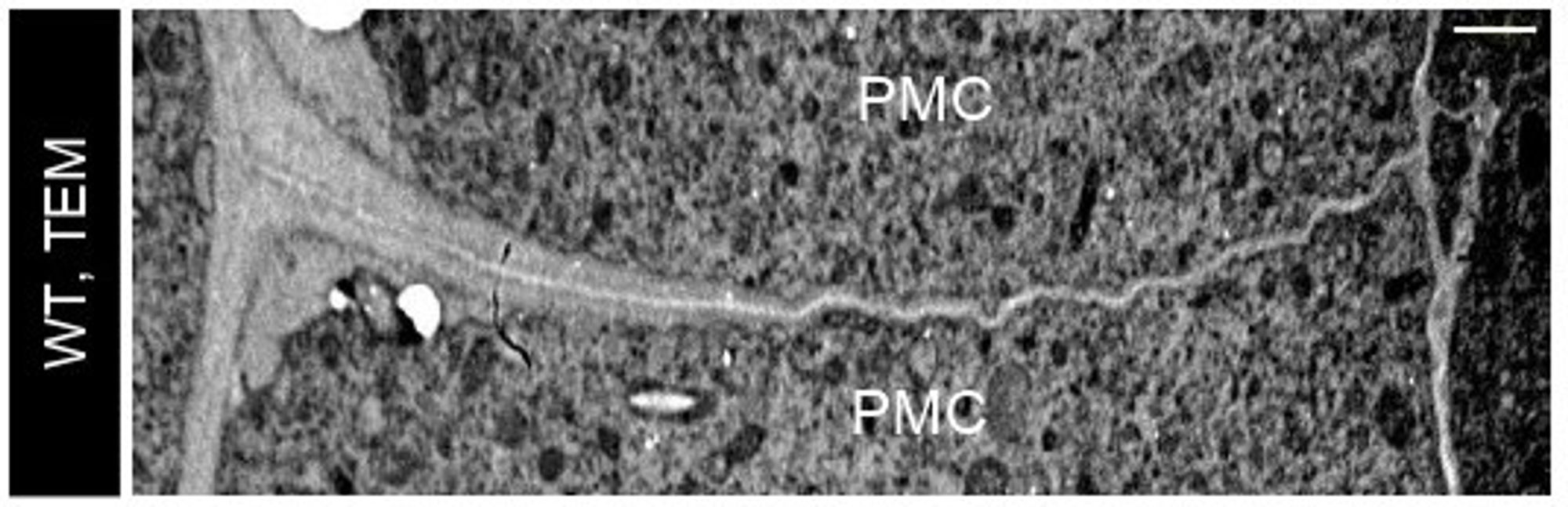 Figure showing callose deposition and Extracellular distance in Osgsl5-3 mutant anthers underpin differences in the shaping of pollen mother cells (PMC), using electron microscopy.