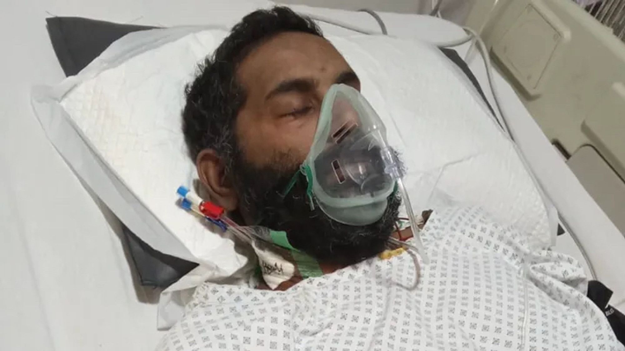 A man in critical condition in a hospital wearing an oxygen mask