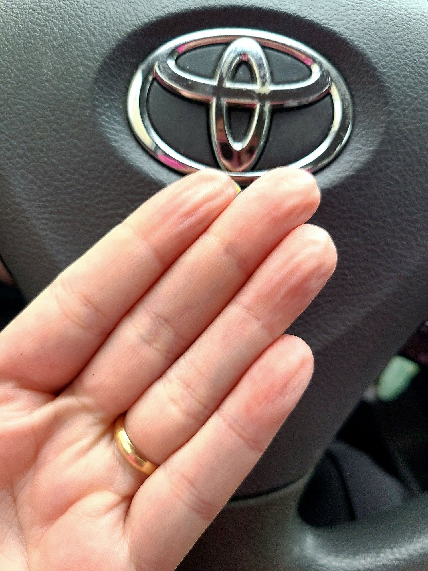 My fingers looking all pruney, but not from being in water for too long, rather from Raynaud's syndrome.