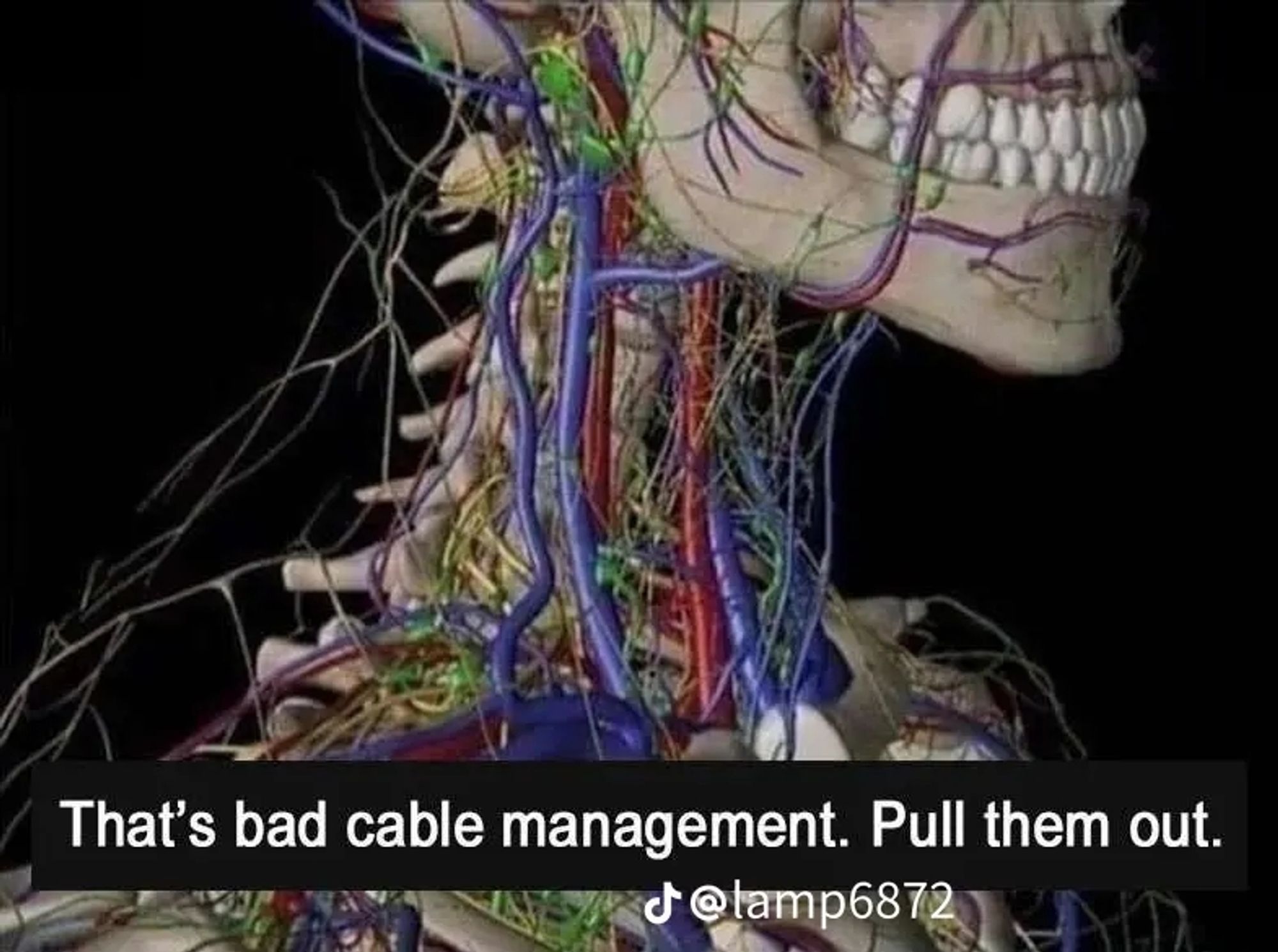 diagram depicting blood vessels in the human body with text that says "that's bad cable management. pull them out."