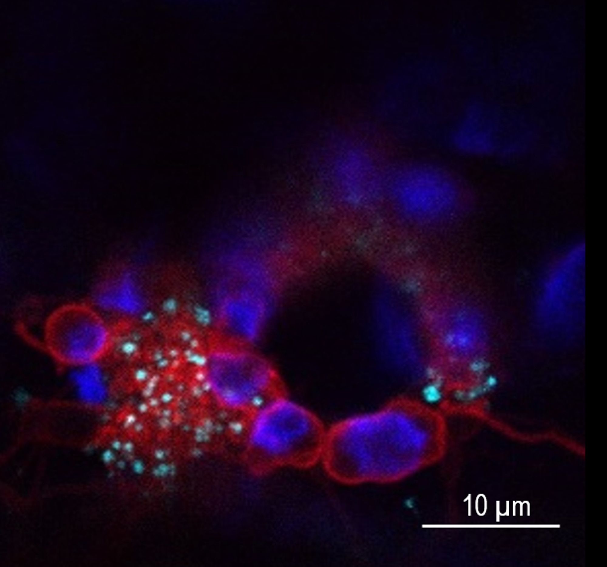 Accumulation of lipid droplets in plant cells in response to TuMV virus (confocal microscope observation). Virus replication vesicles are marked in red, chloroplasts in dark blue and lipid droplets in cyan blue. Scale: 10 µm.