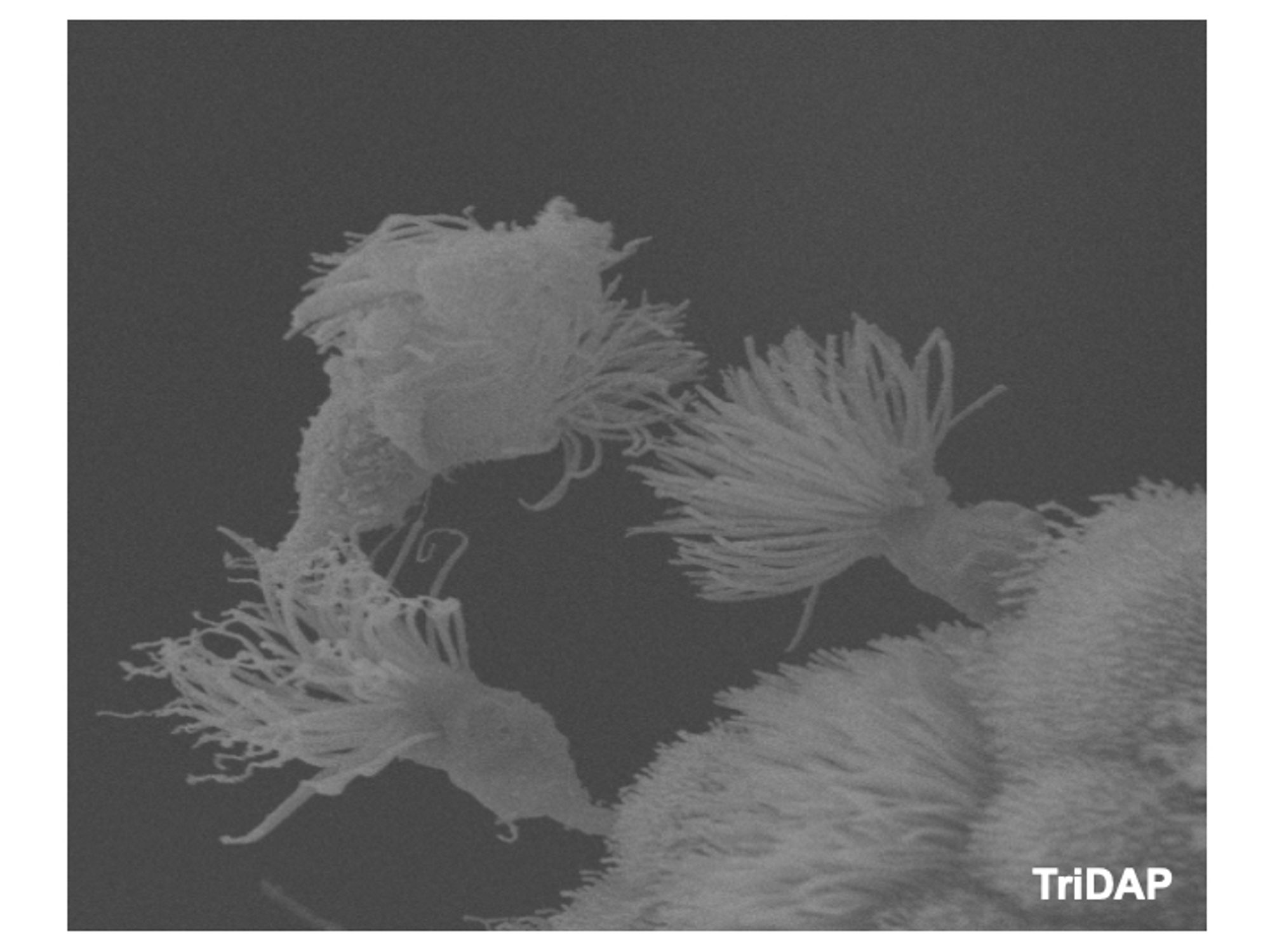 Ciliated Fallopian tube cells slough from the epithelium in response to purified tripeptide peptidoglycan monomer (GlcNAc-anhydro-MurNAc-Ala-iGlu-Dap).