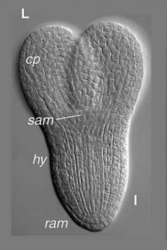 Embryon d’Arabidopsis thaliana au stade torpille