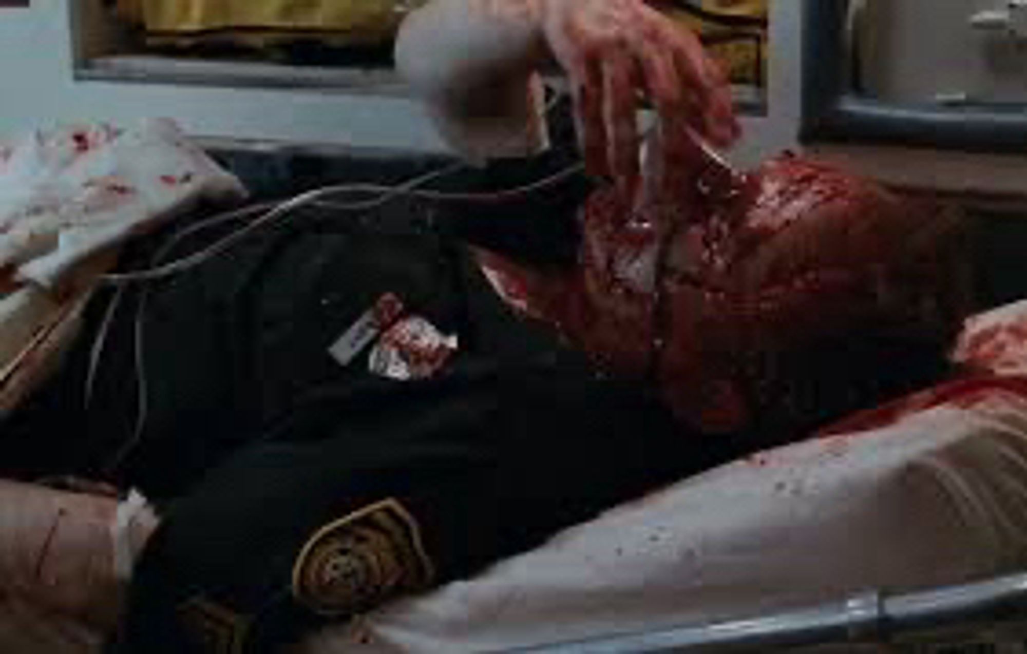 Hannibal Lecter in The Silence of the Lambs. He is on a gurney in an ambulance and he is wearing the cut off face of a policeman he killed during his escape