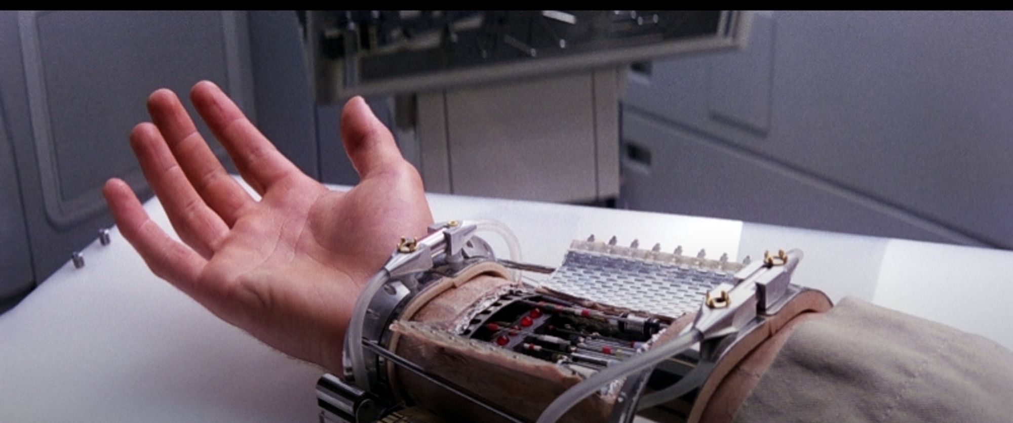 Luke Skywalker"s prosthetic hand being attached in athe Empire Strikes Back