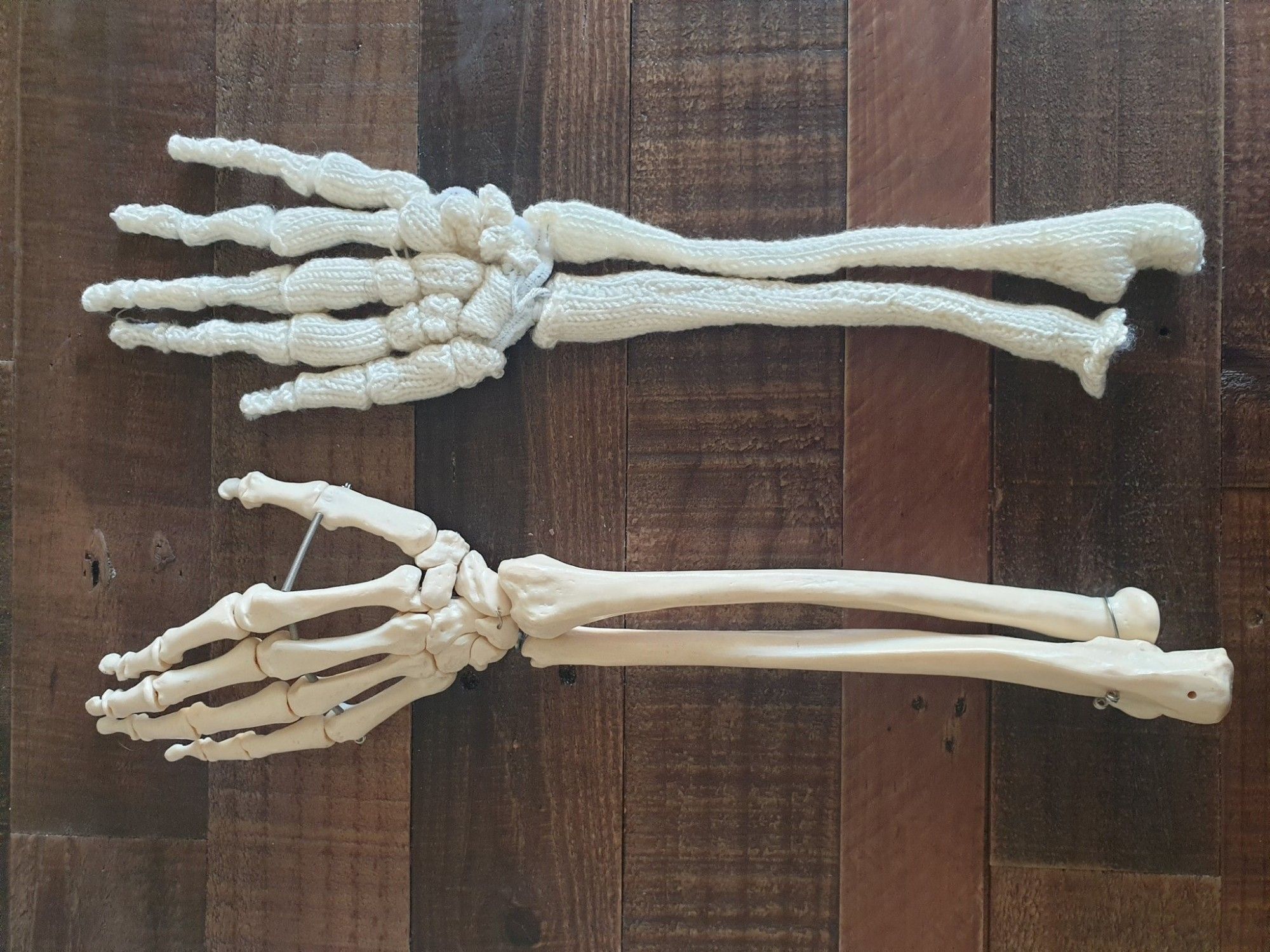 A photograph showing two skeleton arms up the the elbow, layed next to each other on a wooden table. One is made from resin, the other is knitted.