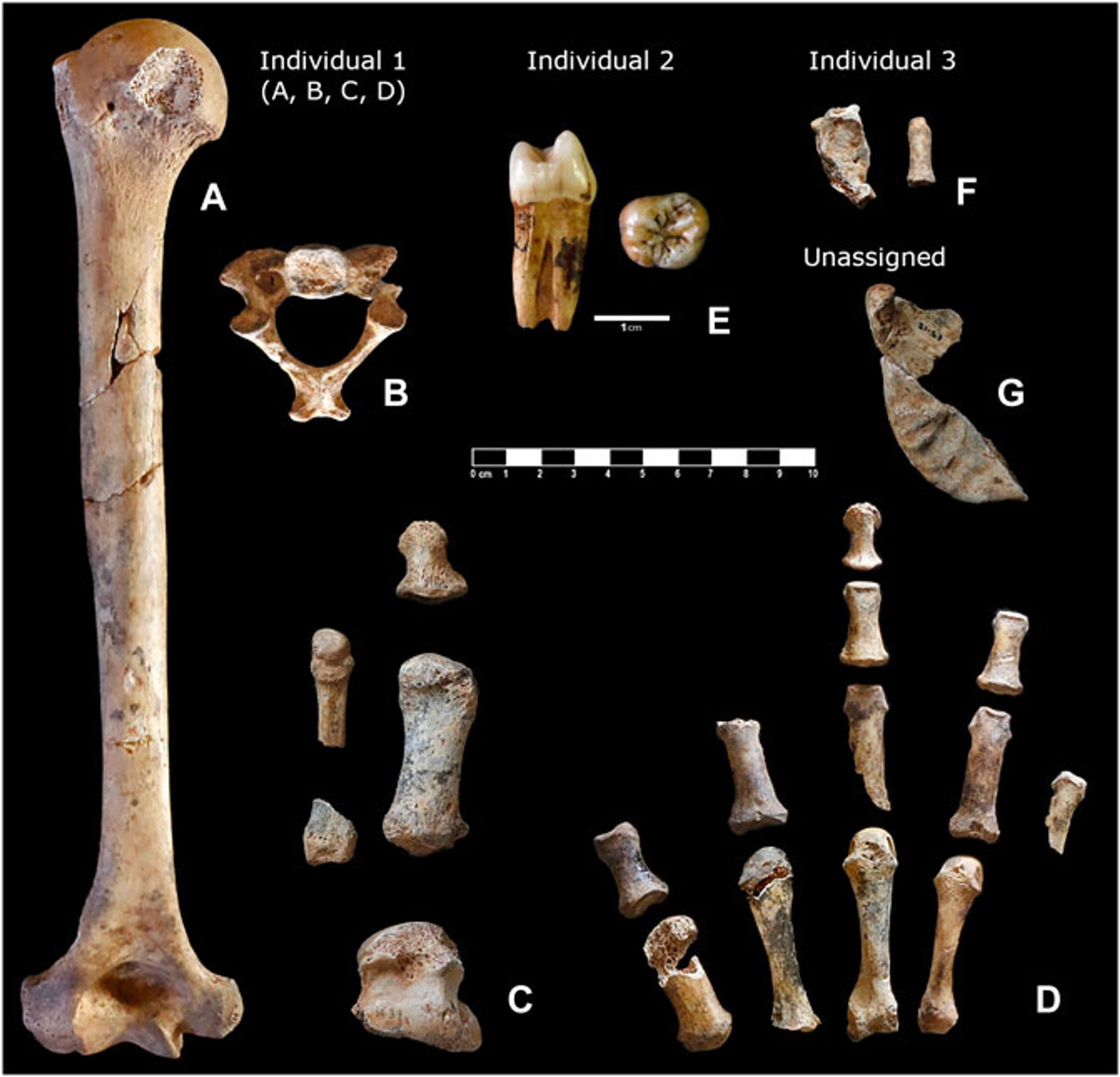 Foremost Neanderthal remains found at the Simanya Gran gallery from Cova Simanya (Barcelona, Spain). Skeletal remains are distributed according to their attribution to specific individuals. (A) Left humerus; (B) shaft, caudal view; (C) bones of the foot; (D) bones of the right hand; (E) upper P3 and M3; (F) fragment of the atlas and first phalanx of the hand; and (G) fragment of the ascending branch.