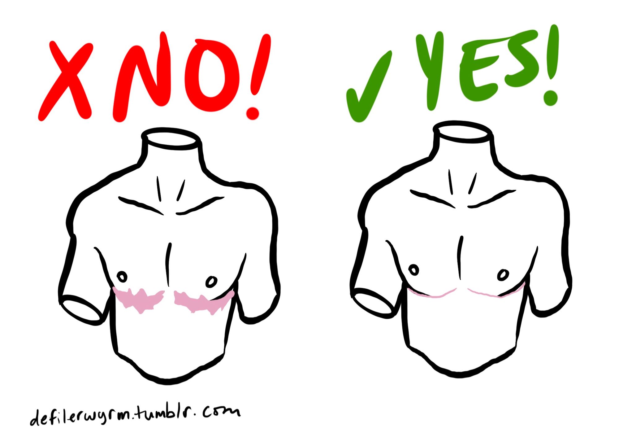 Digital drawing of two simplified masculine torsos. The left has enormous, jagged scars beneath the pecs; above it is a red X and the word “No!” in red caps. The right has thin, fine scars beneath the pecs; above it is a green checkmark and the word “Yes!” in green caps.