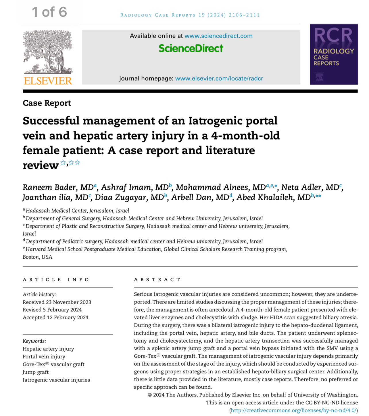 Radiology Case Reports
Volume 19, Issue 6, June 2024, Pages 2106-2111
Case Report
Successful management of an Iatrogenic portal vein and hepatic artery injury in a 4-month-old female patient: A case report and literature review