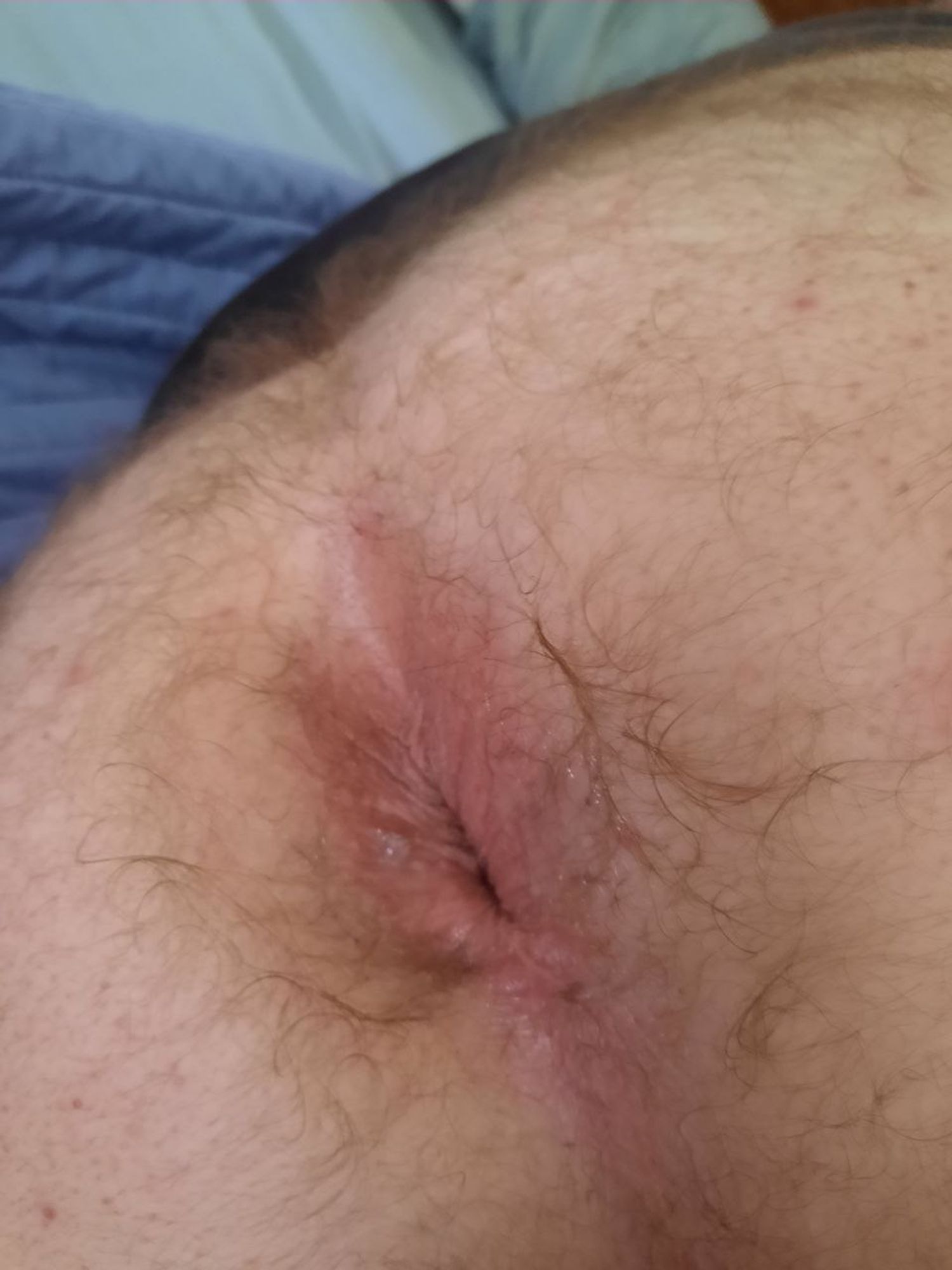 butthole close up