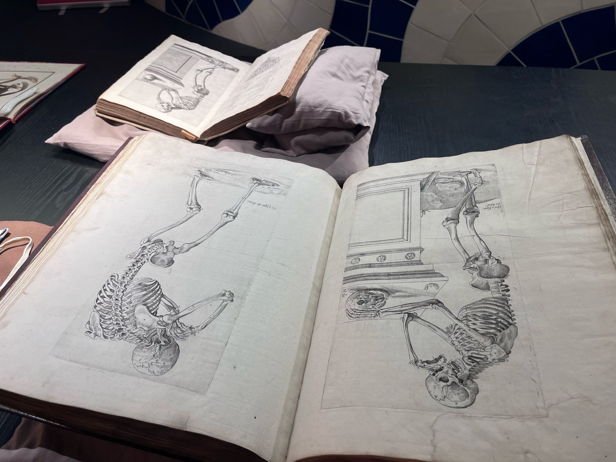 En bild på två uppslagna böcker. En med skelettplanscher från Vesalius’ Fabrica och en med en plagiat på Vesalius från Du Laurens.