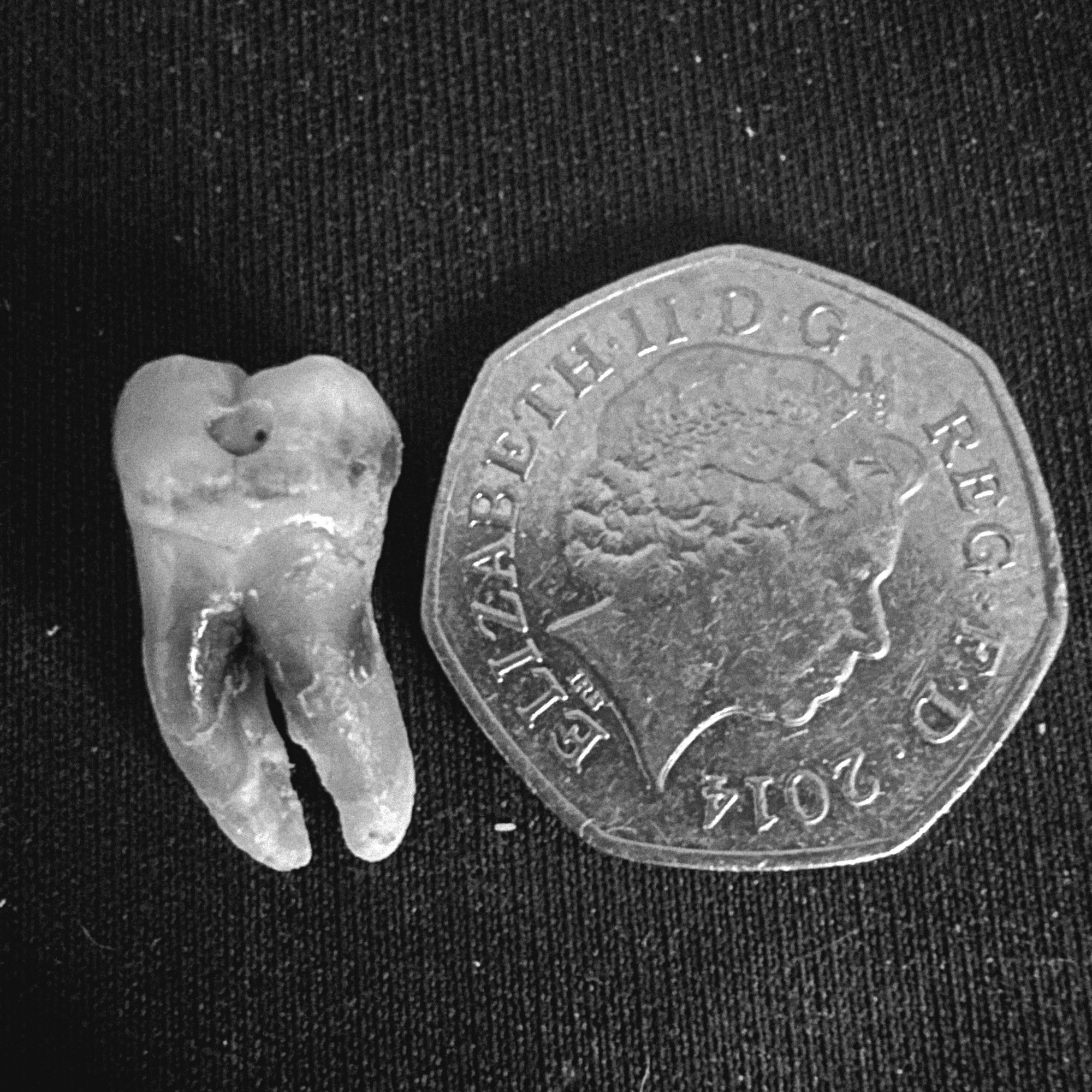 Comparison of a molar tooth and a UK 50 pence piece in size