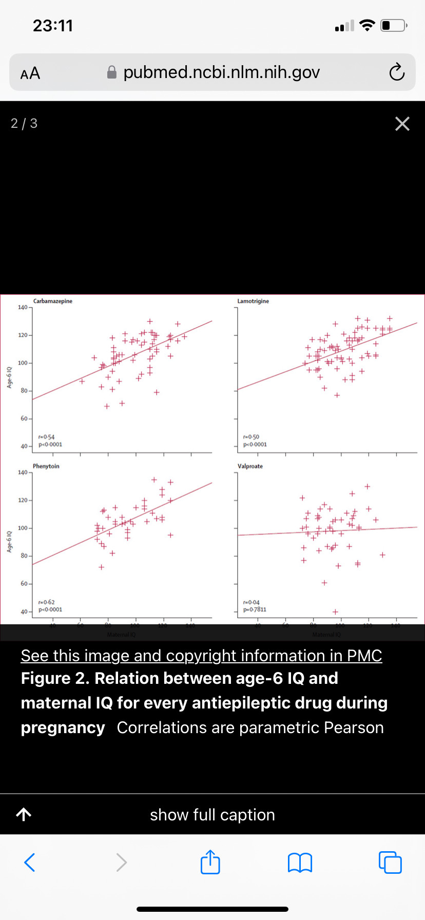 Figure 2. Relation between age-6 IQ and maternal IQ for every antiepileptic drug during pregnancy Correlations are parametric Pearson correlations; non-parametric rank correlations were much the same. Age-6 IQ=IQ scores at 6 years of age. IQ=intelligence quotient. Each of 3 graphs for phenytoin, carbamazepine, and lamotrigine have a nice linear relationship between maternal in and child in. This relationship disappears for valproate which is a neurodevelopmental teratogen. 