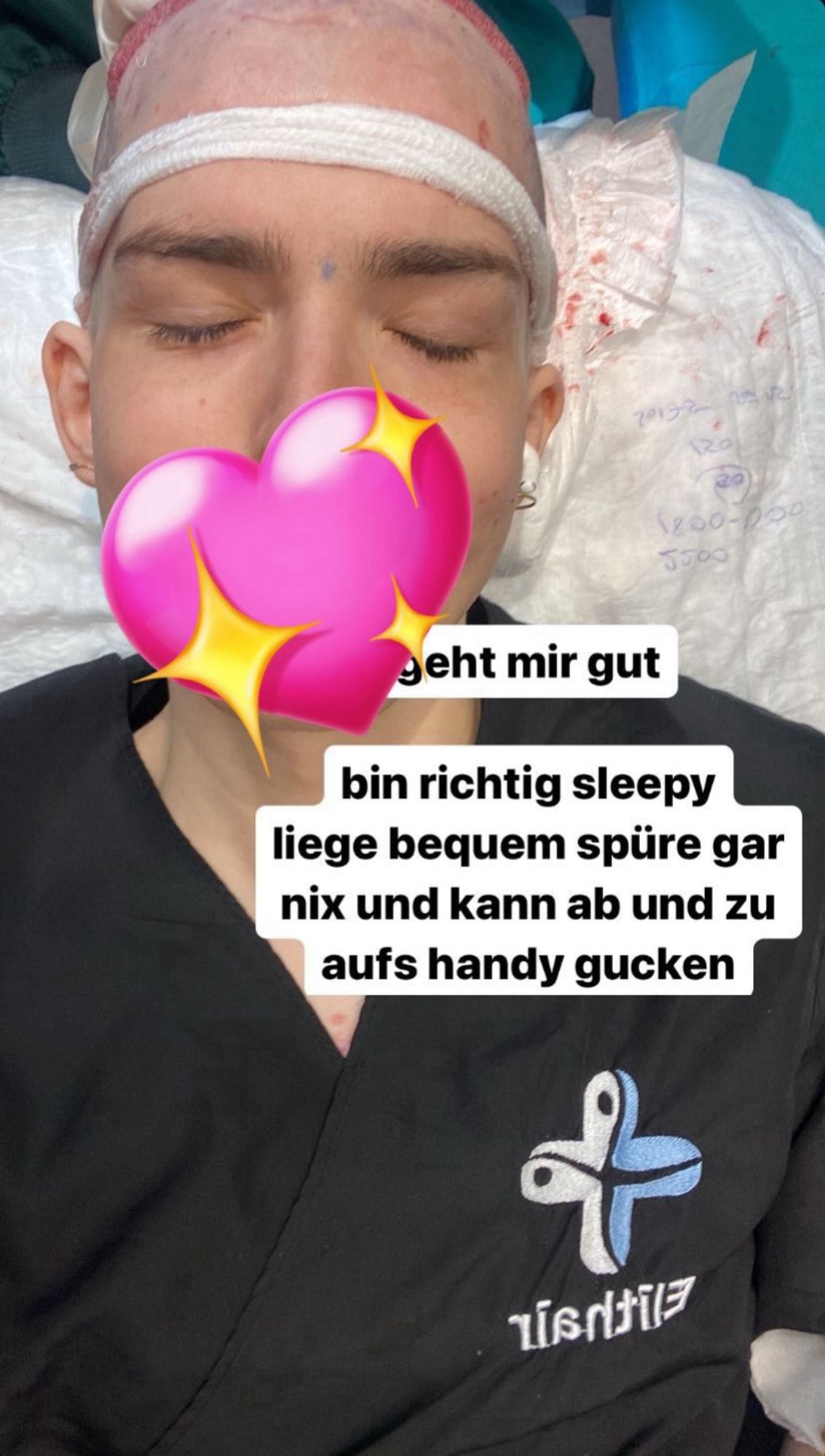 Selfie wie ich auf der Op Liege liege, ein weißer Verbandstreifen um meine untere Stirn knapp über der Augenbrauen, meine Augen geschlossen. Kopf oben rot wegen der bereits transplantierten besagten Linie. Text im Bild: geht mir gut
bin richtig sleepy liege bequem spüre gar nix und kann ab und zu aufs handy gucken