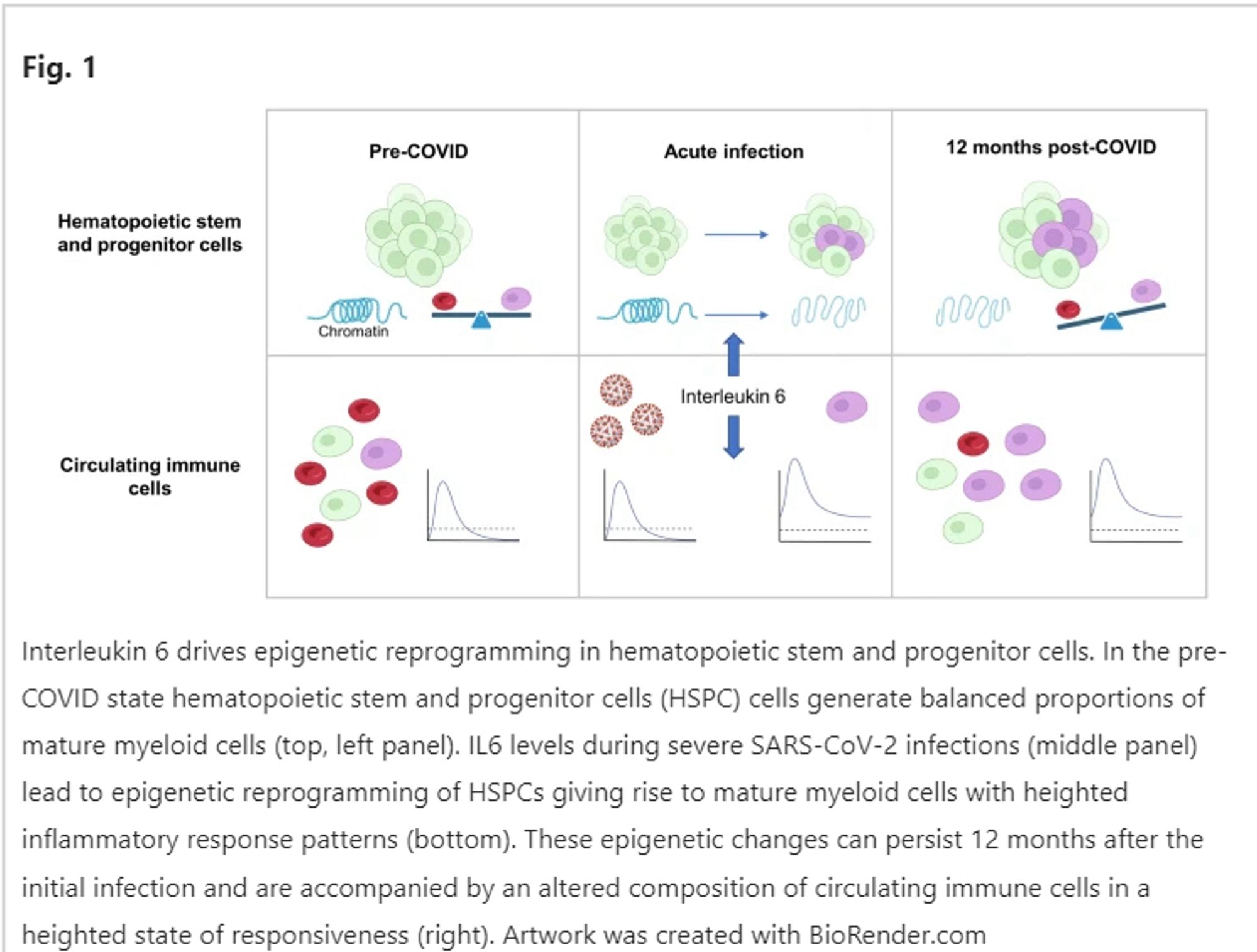 Interleukin 6 drives epigenetic reprogramming in hematopoietic stem and progenitor cells. In the pre-COVID state hematopoietic stem and progenitor cells (HSPC) cells generate balanced proportions of mature myeloid cells (top, left panel). IL6 levels during severe SARS-CoV-2 infections (middle panel) lead to epigenetic reprogramming of HSPCs giving rise to mature myeloid cells with heighted inflammatory response patterns (bottom). These epigenetic changes can persist 12 months after the initial infection and are accompanied by an altered composition of circulating immune cells in a heighted state of responsiveness (right).