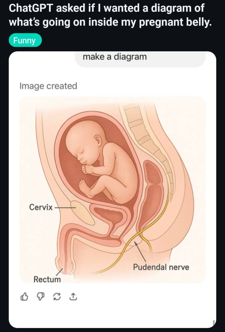 ChatGPT asked if I wanted a diagram of what's going on inside my pregnant belly.

Funny

Image created

Cervix

make a diagram

Pudendal nerve

Rectum