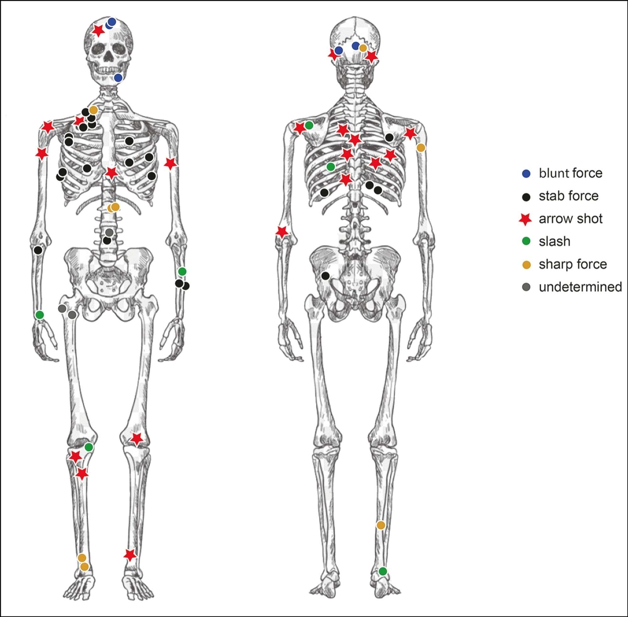 Location and nature of injuries from the Tollense Bronze Age conflict site. Credit Inselmann L, Krüger J, Schopper F, Rahmstorf L, Terberger T. Warriors from the south? Arrowheads from the Tollense Valley and Central Europe. Antiquity. Published online 2024:1-19. doi:10.15184/aqy.2024.140