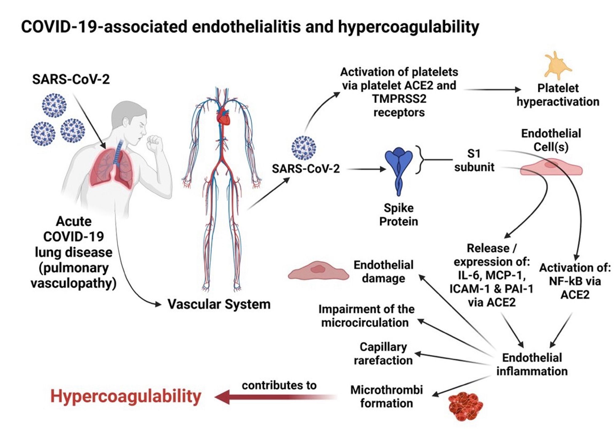 COVID-19-associated endothelialitis and hypercoagulability