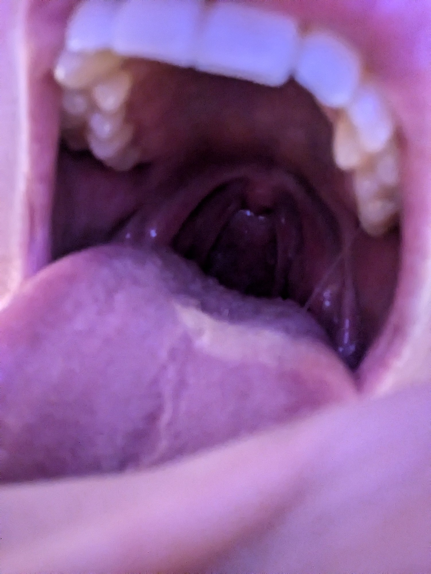 A close up picture of a Doni's open mouth.  Visible is the upper lip, upper teeth, mouth cavity to back of throat, tongue which extends down out of view and the webbing of a hand (as if holding the viewer)