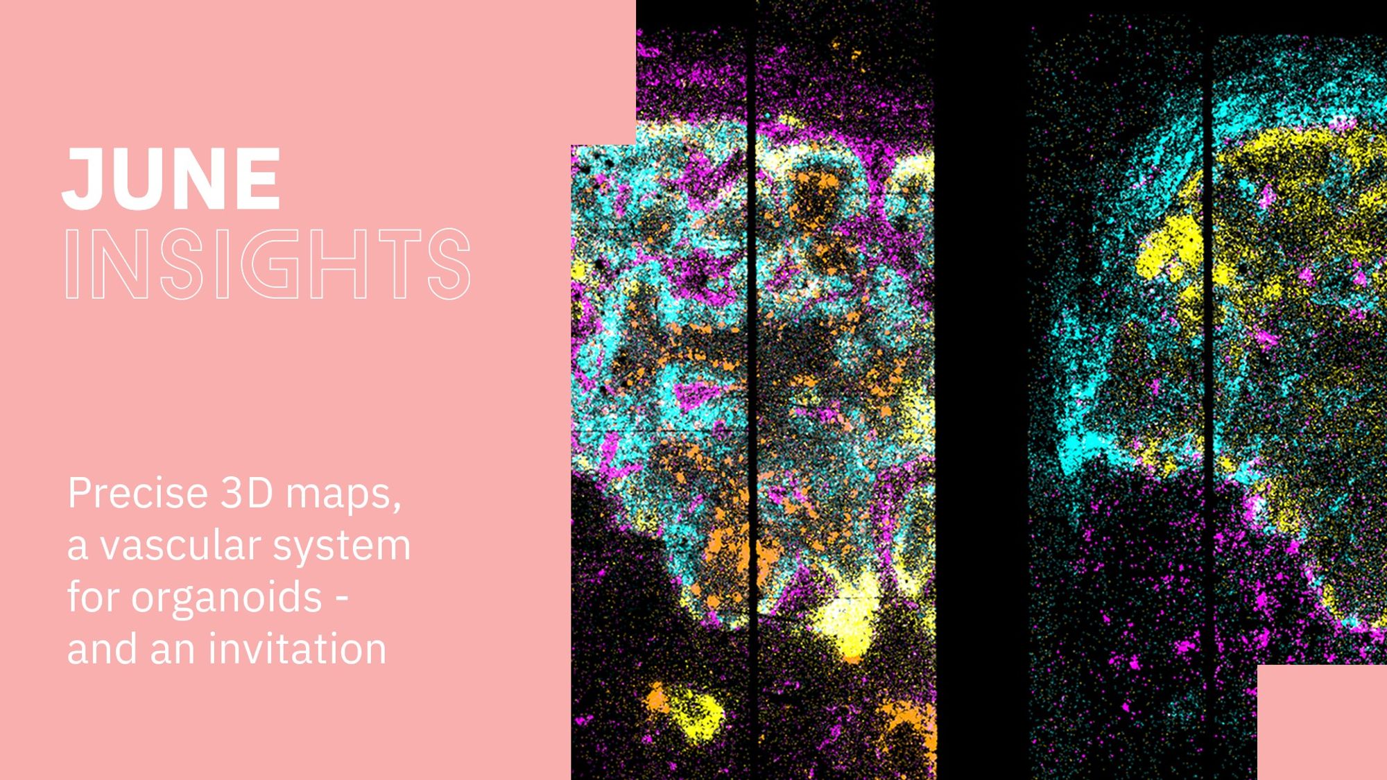 Graphik with text: the image shows a 2D gene expression map in the metastatic lymph node. The text reads: Precise 3D maps, a vascular system for organoids – and an invitation. © AG N. Rajewsky, Max Delbrück Center