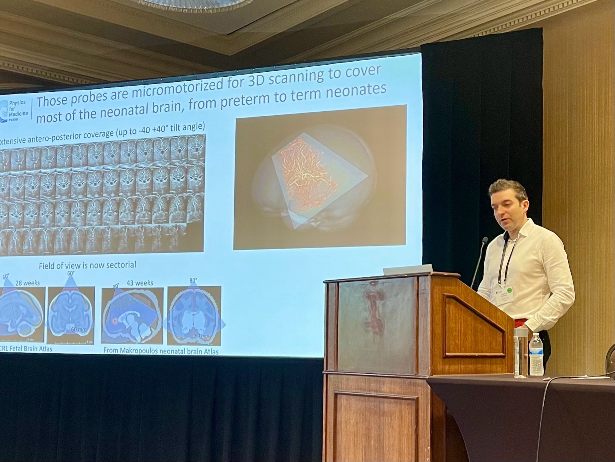 Charlie Demene presenting his work on ultrafast functional brain ultrasound