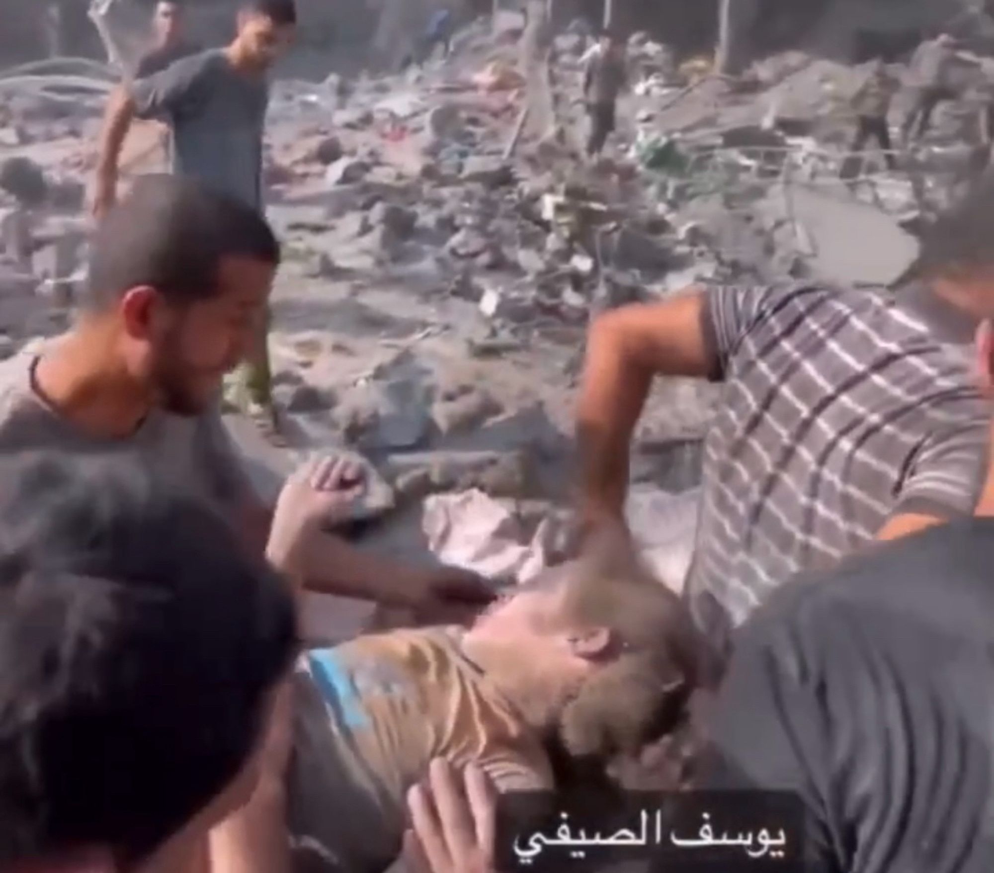 Man talking to the girl in the post on a stretcher, covered in dust