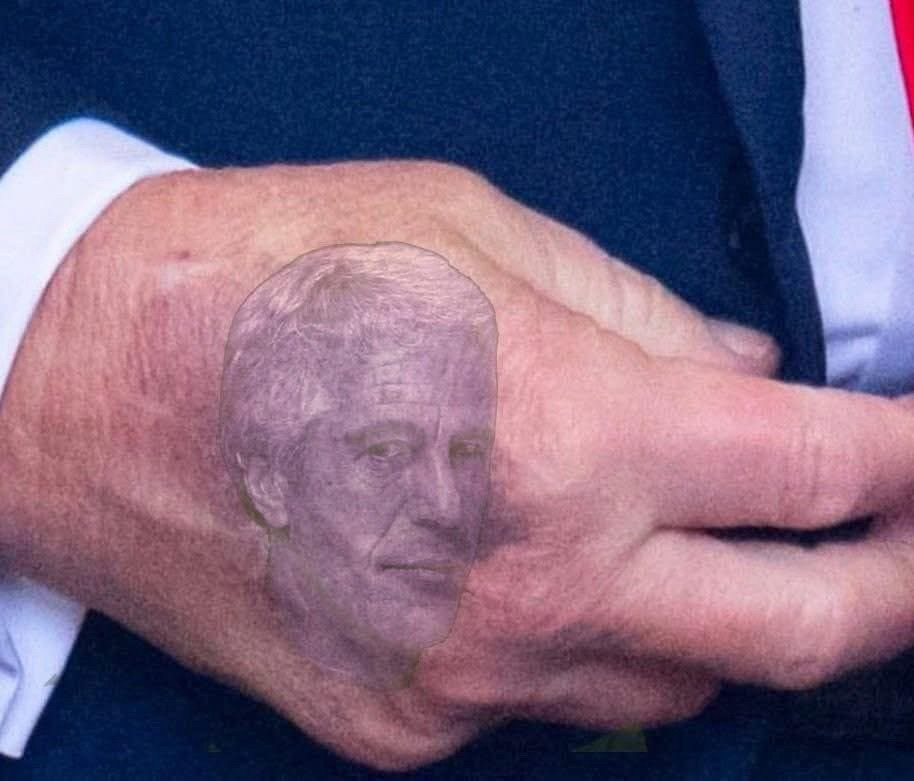 A bruise resembling Epstein, on the back of a short fingered vulgarian. 