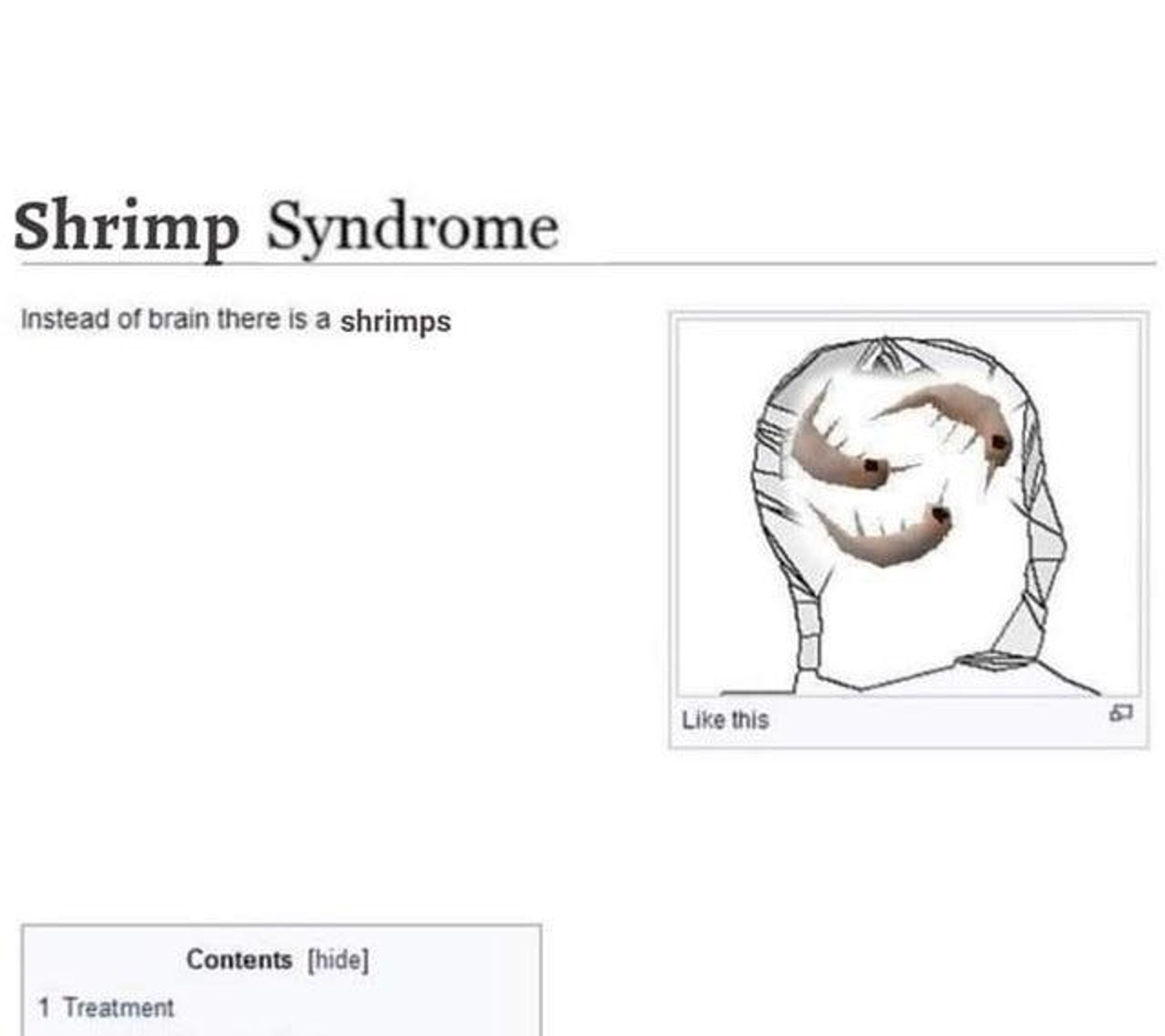 wikipedia style page that describes shrimp syndrome. "instead of brain there is a shrimps"
image attached contains a diagram of a head with shrimps inside