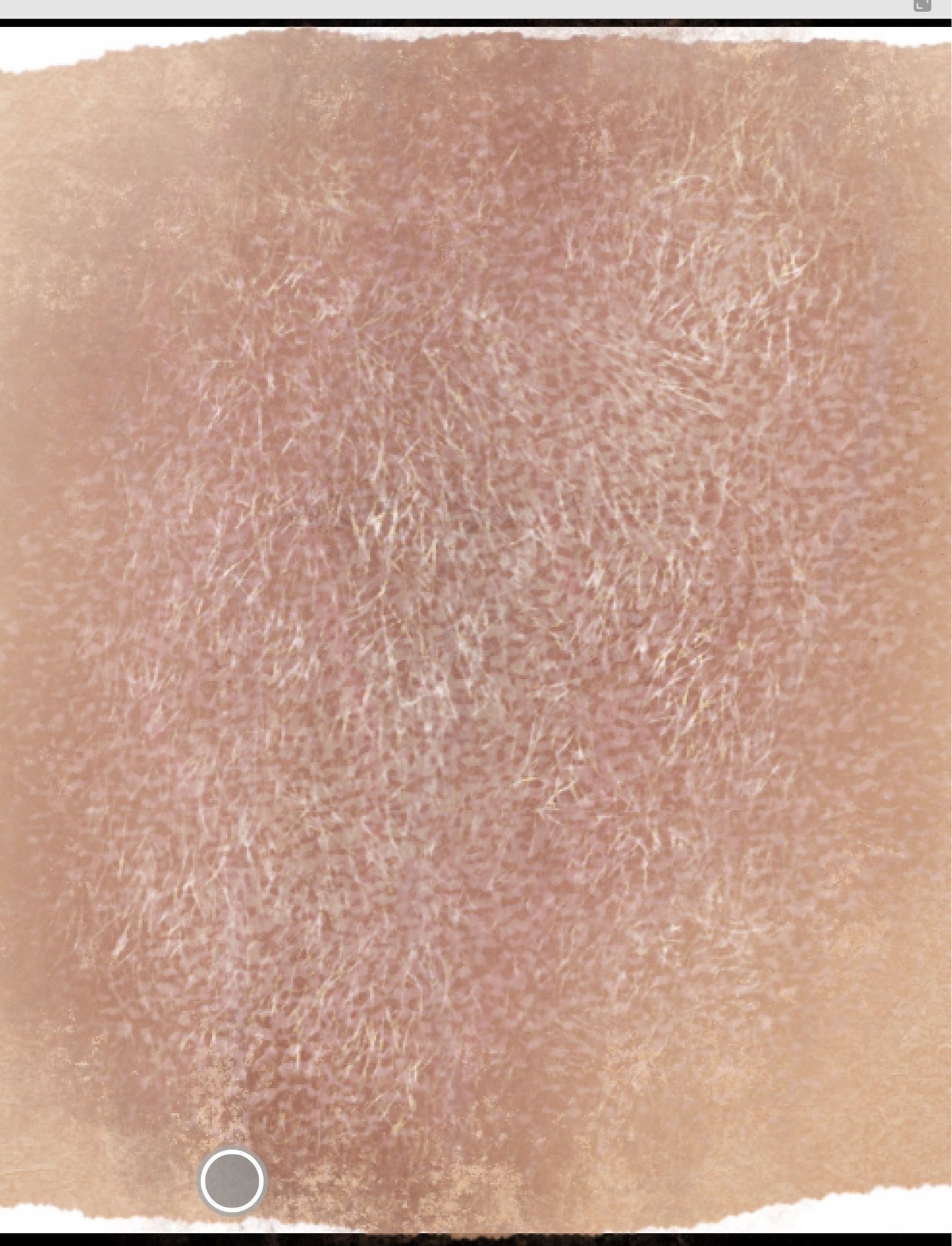 a closeup of a skin swatch from my skin swatch board, showing slightly bruised and sunburnt medium-light pinkish tan skin with a layer of silky blonde hair on top