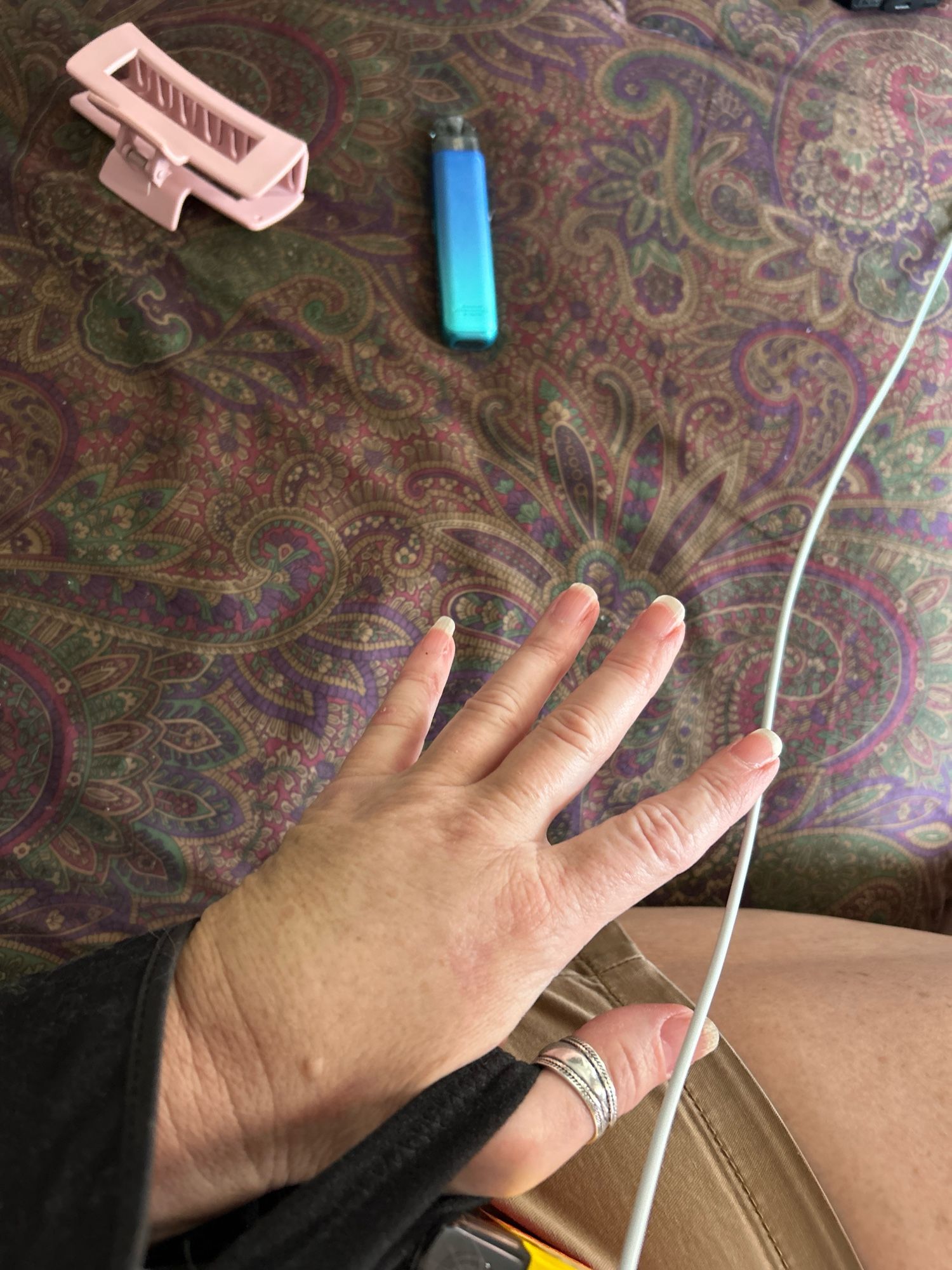 White woman hand, so hurty and swollen, extends from a sling. A pink hair clip and a blue/green vape (new) are on the paisley comforter(colors: purple, burgundy, and green, with 2 gold colors)