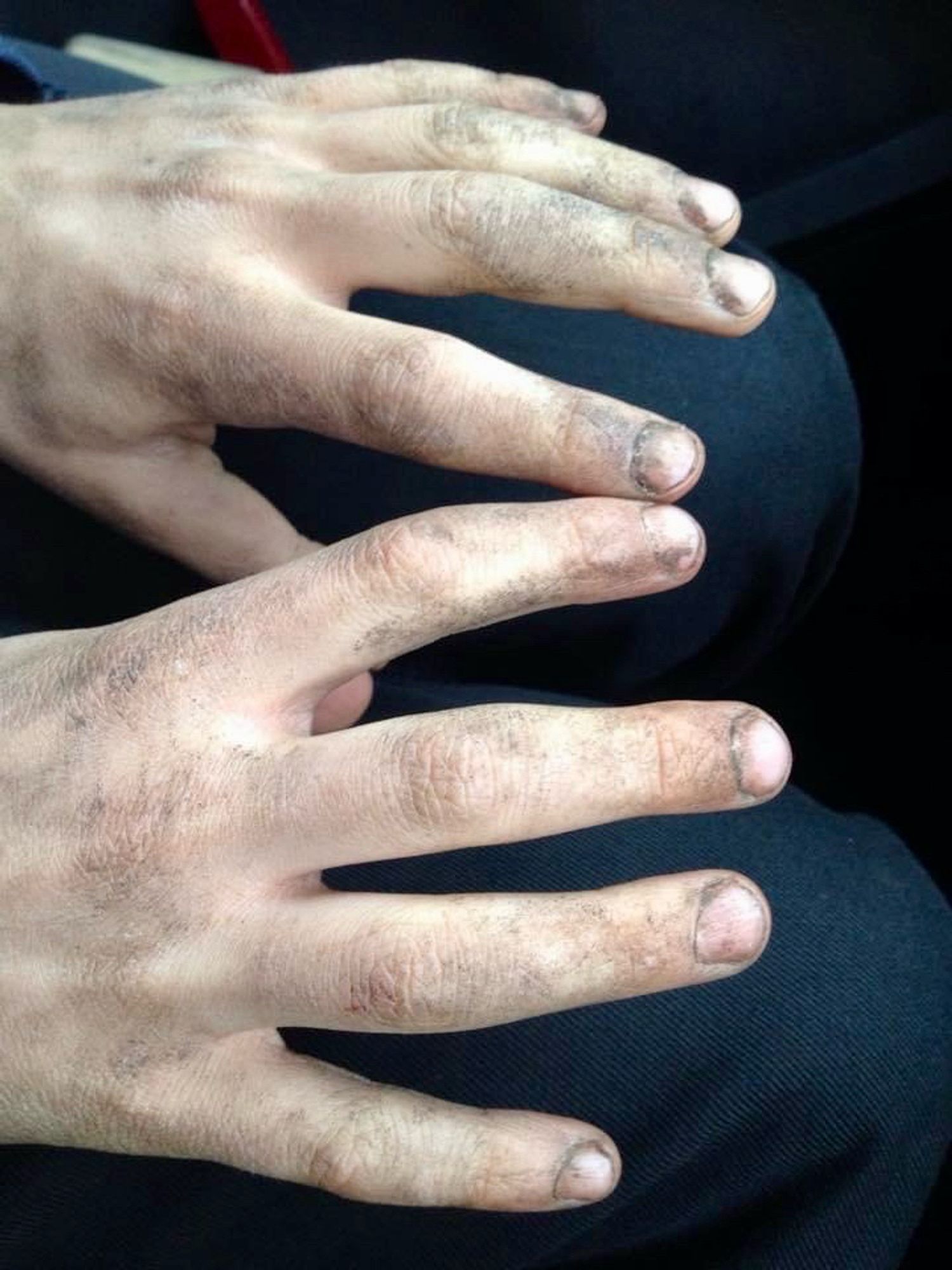 Close up picture of a child’s hands, engrained with dirt from playing, just a beautiful sight