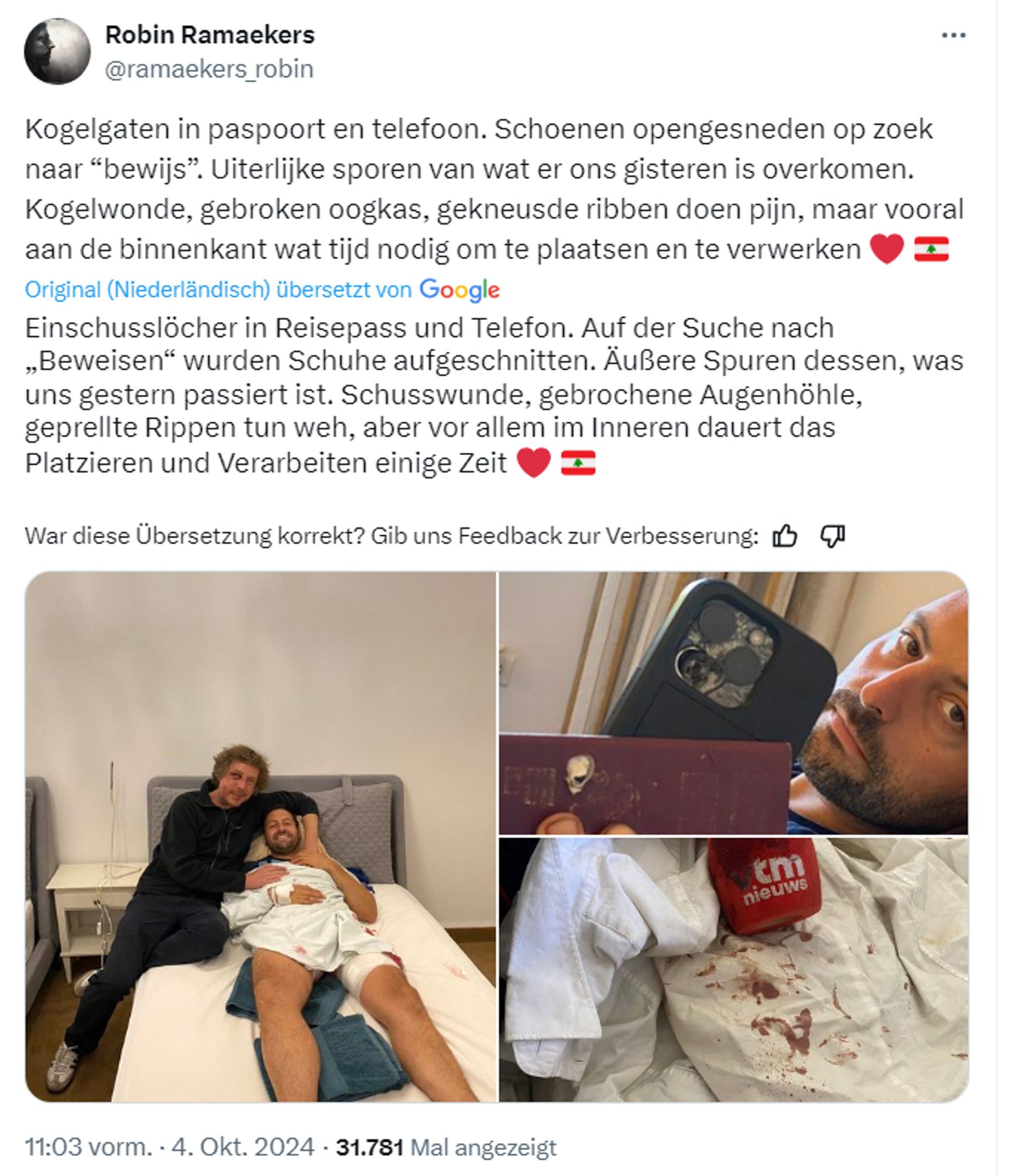 Robin Ramaekers

Einschusslöcher in Reisepass und Telefon. Auf der Suche nach „Beweisen“ wurden Schuhe aufgeschnitten. Äußere Spuren dessen, was uns gestern passiert ist. Schusswunde, gebrochene Augenhöhle, geprellte Rippen tun weh, aber vor allem im Inneren dauert das Platzieren und Verarbeiten einige Zeit