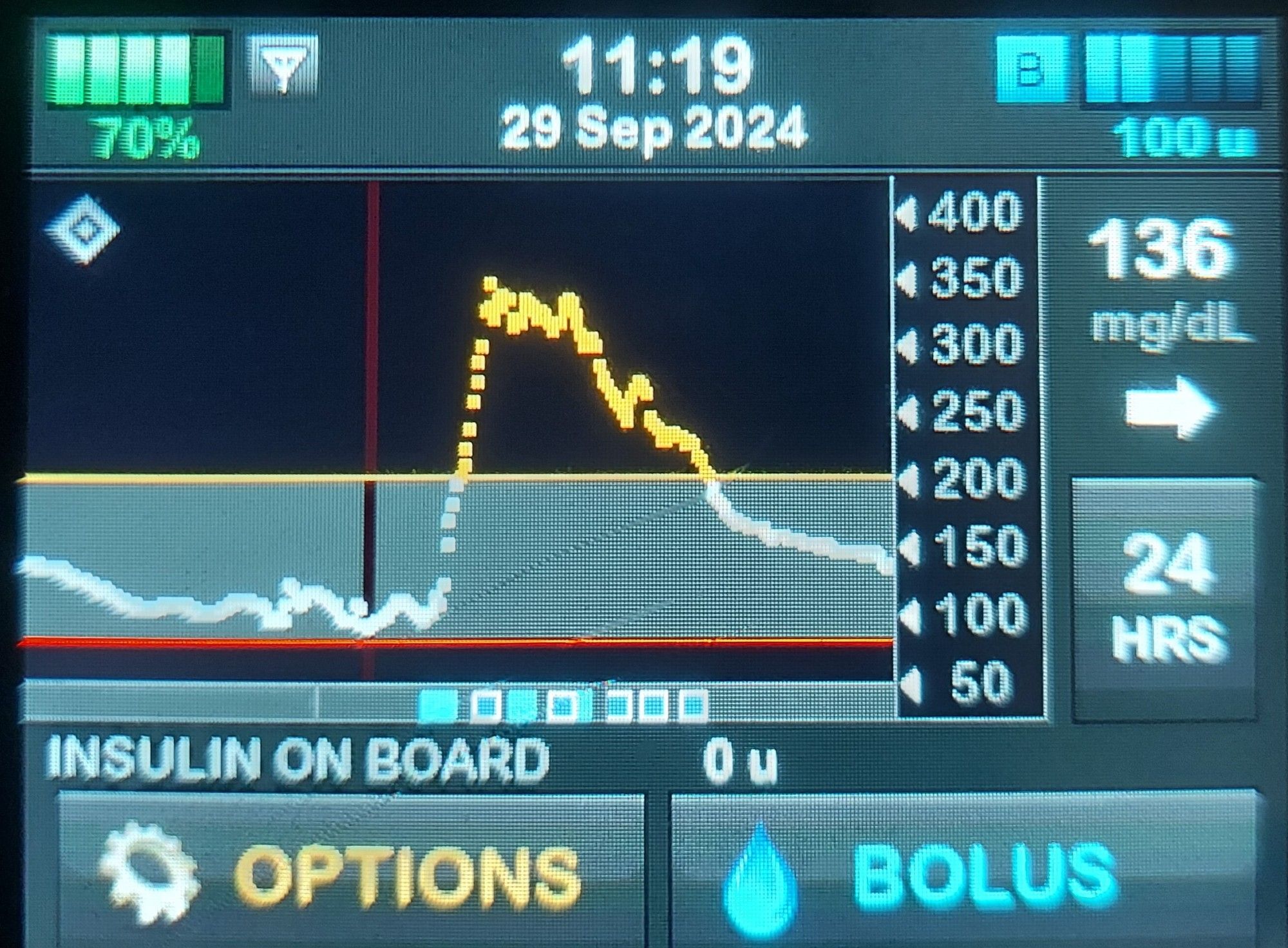 A display from an insulin pump showing blood glucose levels over a 24-hour period. The first ~12 were flat at 100-120mg/dL, which jumped to ~350 for ~4 hours, then taking another 4 fours to drop below 200, eventually steadying ~150. The timing of multiple manual bonuses as well as AI-delivered bonuses on display.