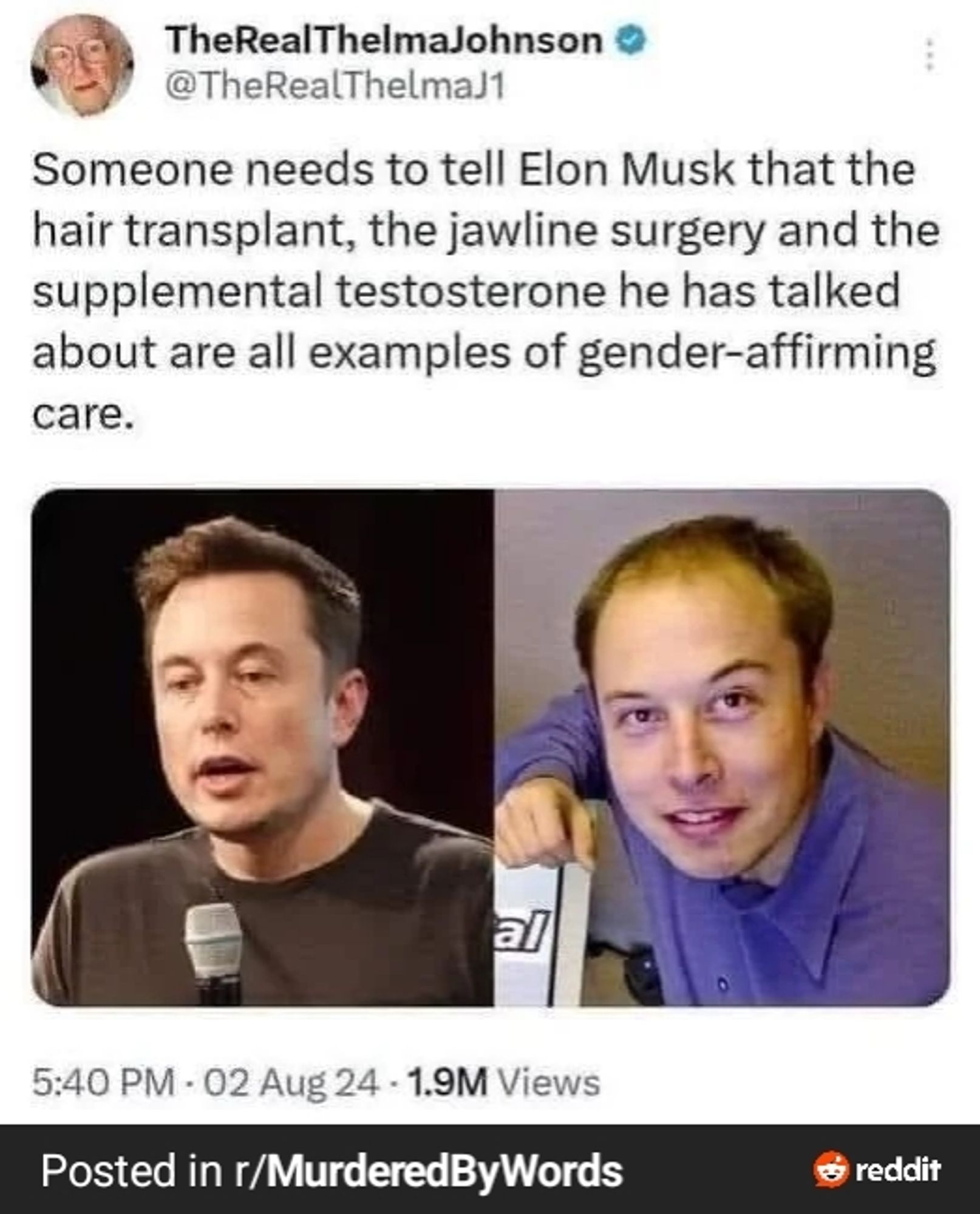 Meme of new versus old Elon Musk. The text on the meme says: Someone needs to tell Elon Musk that the hair transplant, the jawline surgery and the supplemental testosterone he has talked about are all examples of gender-affirming care. The left image shows his current self, which displays a middle-aged white man with a healthy young hairline and strong jaw. The right image shows a younger him, where he has a large bald patch with a poorly done comb-over. The yonger him also has a significantly weaker jawline that would typically be considered feminine.