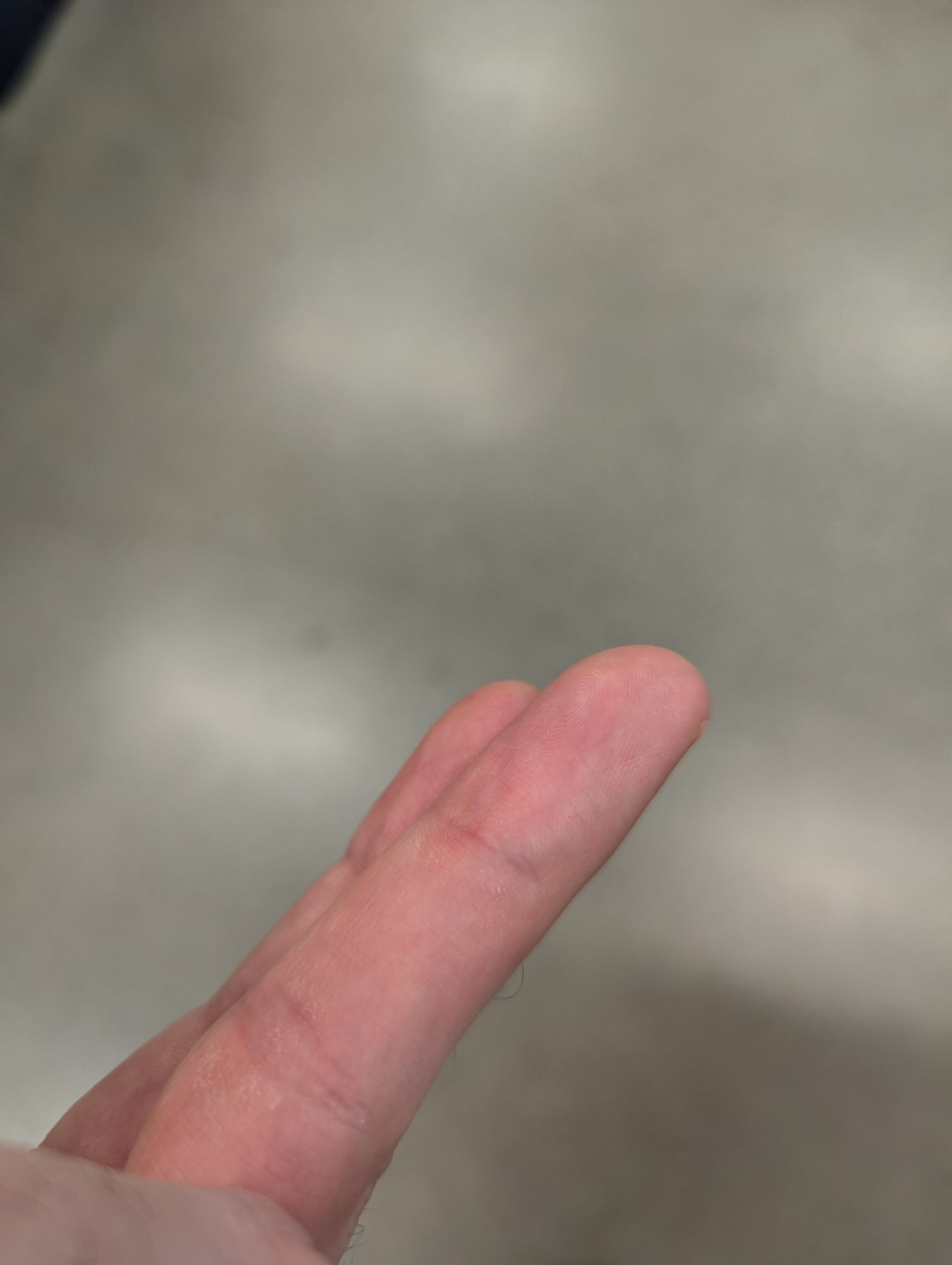 Photo showing the inside of the middle finger of my left hand. Nothing of note can be seen.