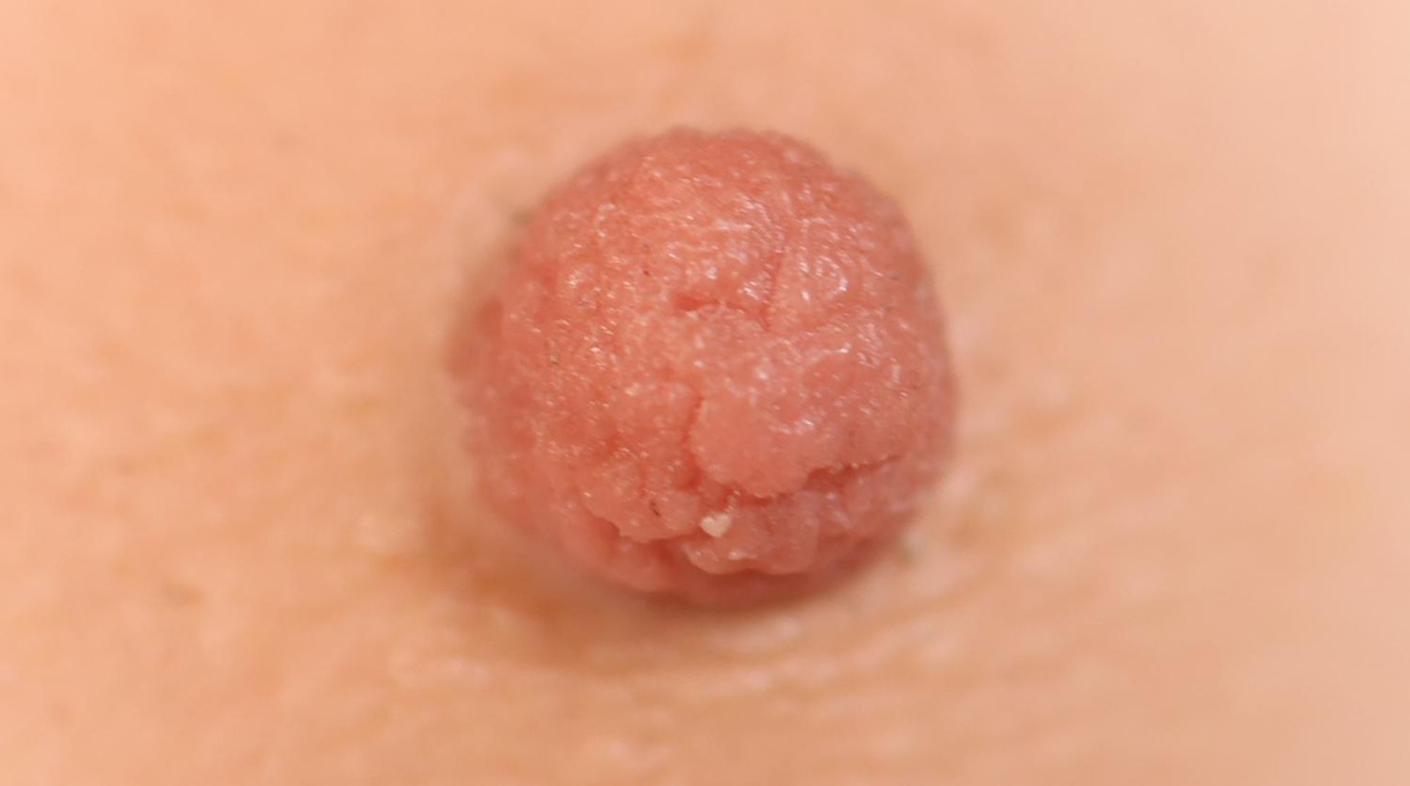 close up nipple