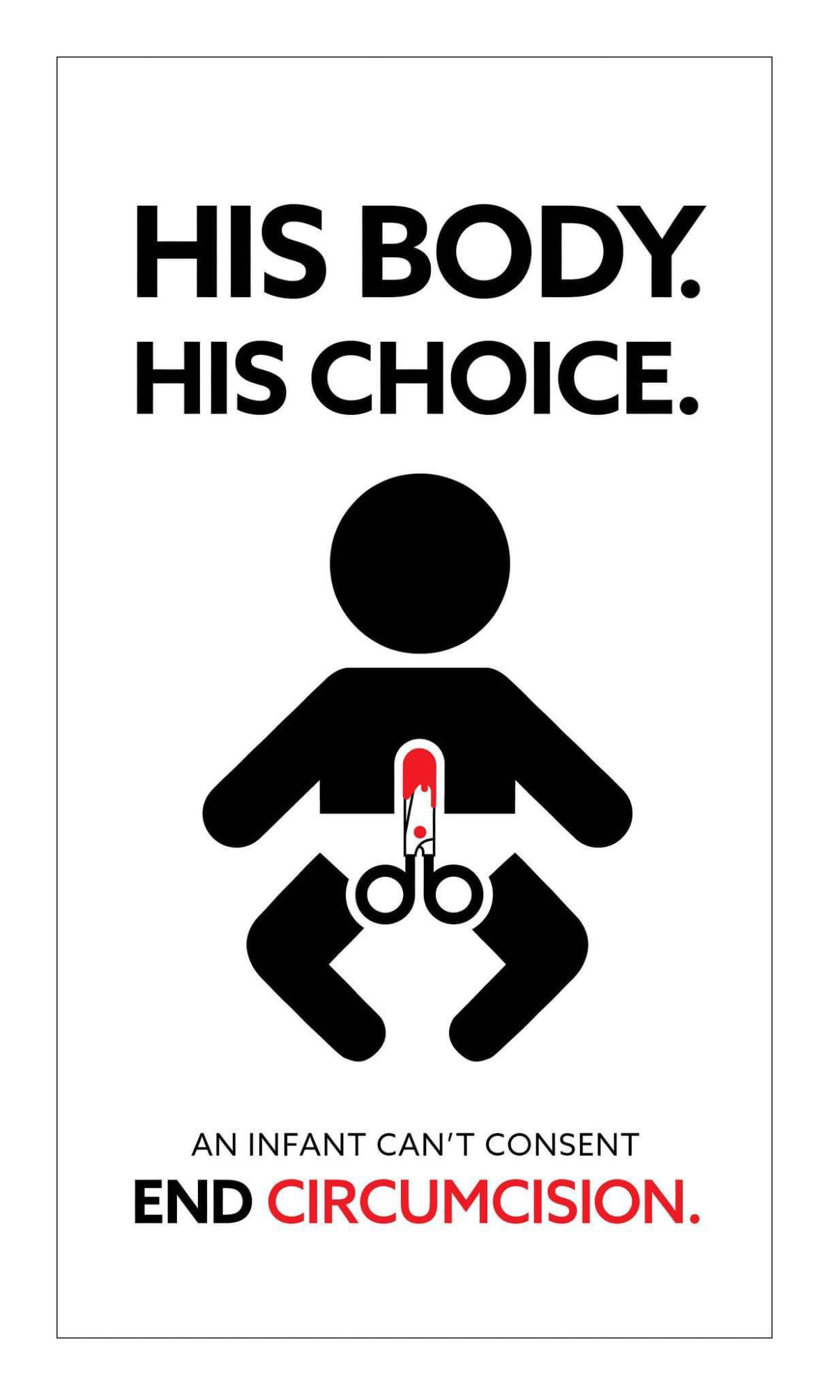 Graphic depicting a stylized infant male circumcision with the top text "His Body. His Choice" and bottom text "An Infant can't consent End Circumcision"