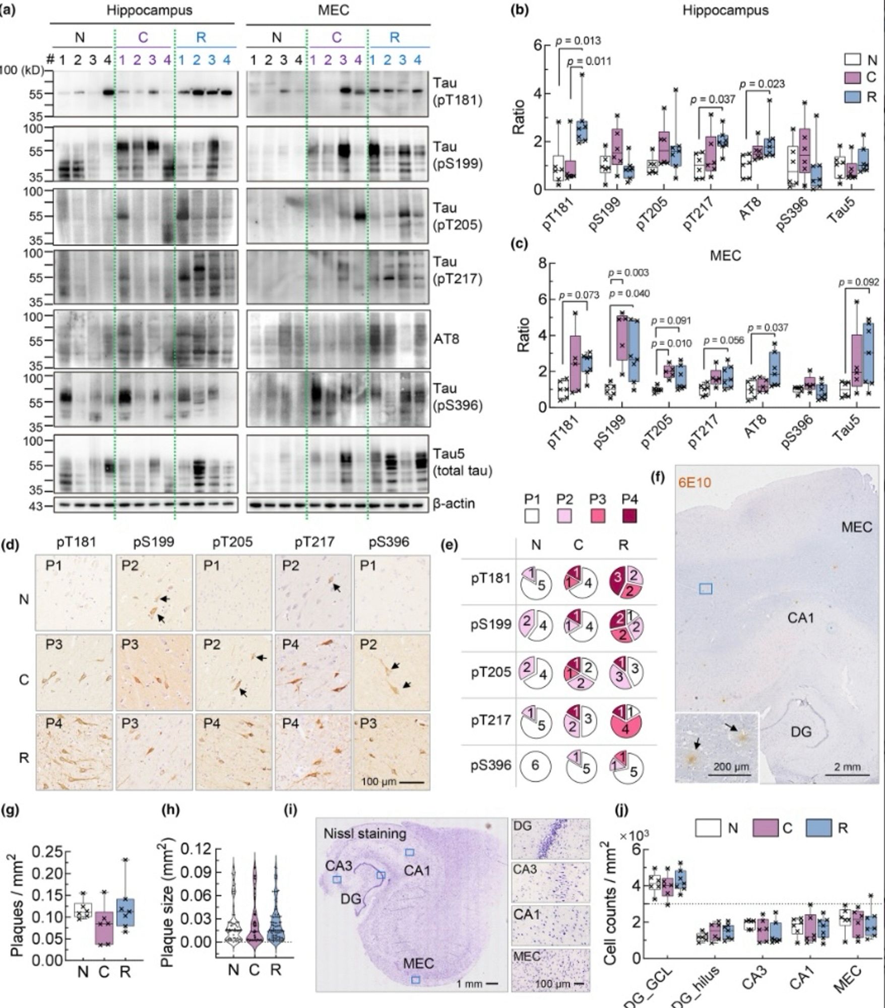 Upregulation of pTau in the hippocampus and MEC post COVID-19. (a–c) pTau at specific epitopes like Thr181, Thr217 and AT8 were upregulated in the hippocampus and MEC post-acute COVID-19. Grouping: N, non-infected; C, acute COVID-19; R, recovery from COVID-19. N = 6–7 in each group, one-way ANOVA followed by Tukey's multiple comparisons tests. Data were normalized by the mean value of group N for each pTau epitope. Extended blots were shown in Figure S1. (d, e) Measurement of pTau distribution pattern in the hippocampus and MEC indicated increase of pTau aggregation post-acute COVID-19. Representative images showed pattern 1–4 (P1–P4) of pTau accumulation for each epitope and in each group (d). Numbers in pie charts indicated the counts of patients for each pattern (e). N = 6–7 in each group. (f–h) The overall density and averaged size of 6E10-stained Aβ plaques did not change in acute and post-acute COVID-19. N = 6–7 in each group, one-way ANOVA followed by Tukey's multiple …