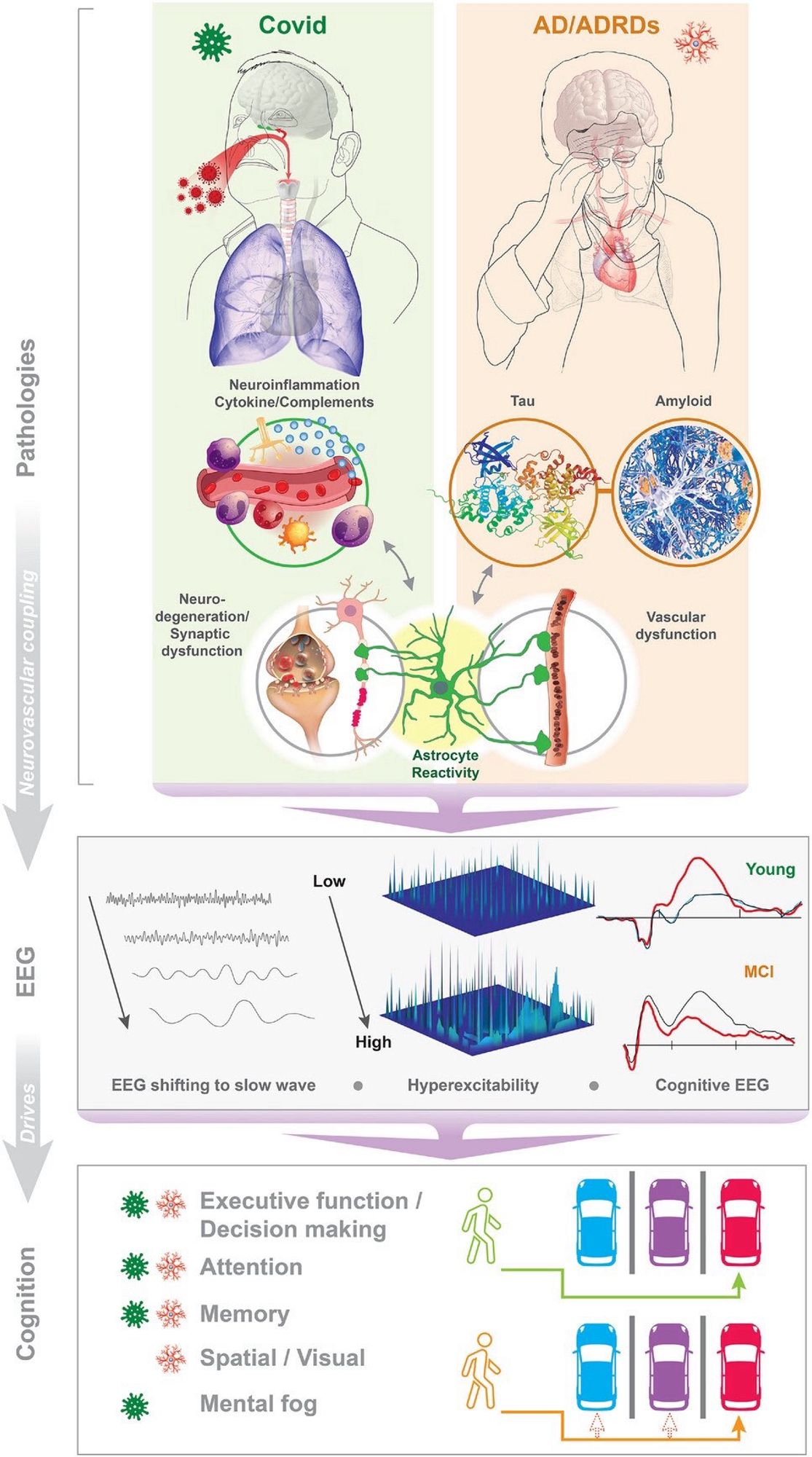 Proposed model: Parallel pathology underlying shared electroencephalographic (EEG) abnormality, and cognitive dysfunction in coronavirus disease 2019 (COVID-19) and Alzheimer's disease/Alzheimer's disease and related dementias (AD/ADRD). (A) Similar pathologies between COVID-19 and ADRD. Both neural inflammation and cytokine/complement activation in COVID-19, amyloid and tau pathologies in ADRD contribute to astrocyte over-reactivity, leading to synaptic dysfunction in neurodegenerative diseases. Astrocytes are likely a primary target of COVID because of the close interaction with the vasculature. Evidence in Section 6 suggests that astrocytes are indeed injured/activated by COVID infection or infection with similar viruses resulting in neuroinflammation. Parallel changes in astrocyte reactivity are found in ADRDs. In ADRD, astrocyte reactivity is suspected to cause synapse loss and neurodegeneration. What we have learned in the ADRD field may give us clues to how reactive astrocytes…