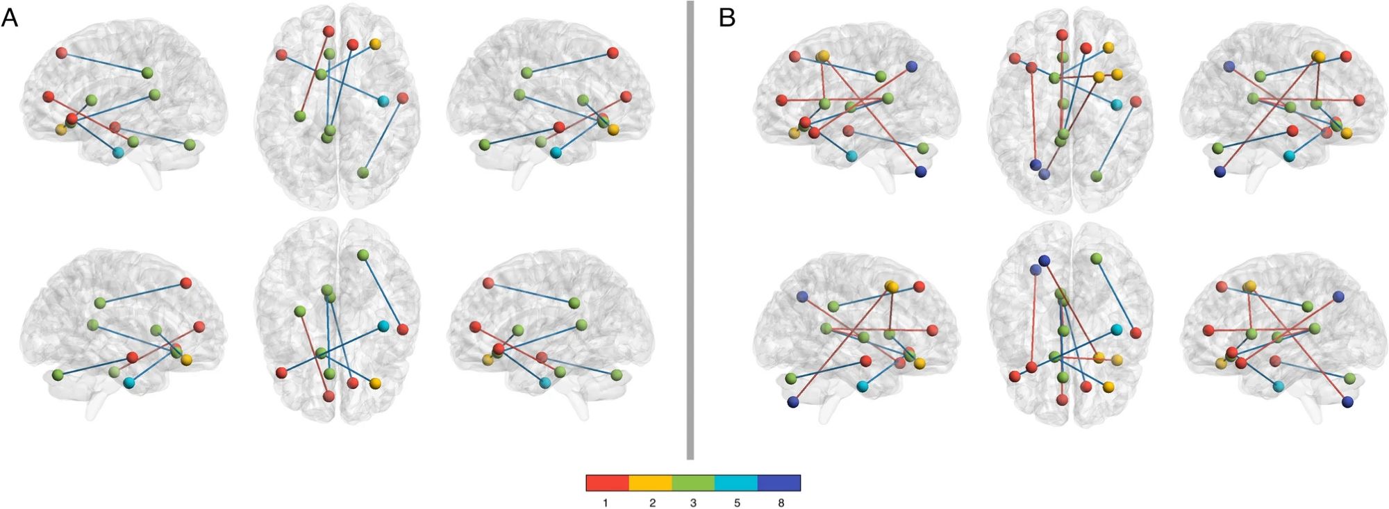 Hypo-connected Functional Connectome Edges Correlated with PROMIS Cognitive and Fatigue Scores. In the COVID group, several hypo-connected edges were significantly correlated with (A) PROMIS Cognitive score (p < 0.043, FDR corrected) and (B) PROMIS Fatigue score (p < 0.034, FDR corrected). Most (83%) of the edges correlated with Cognition were also correlated with Fatigue and these edges are colored in blue. Nodes are colored by their membership in 1 of 8 functional networks evaluated (see color bar): 1: medial frontal, 2: frontoparietal, 3: default mode, 4: subcortical/cerebellar, 5: motor, 6: visual 1, 7: visual 2, 8: visual association (not all networks were significant and therefore are not represented).