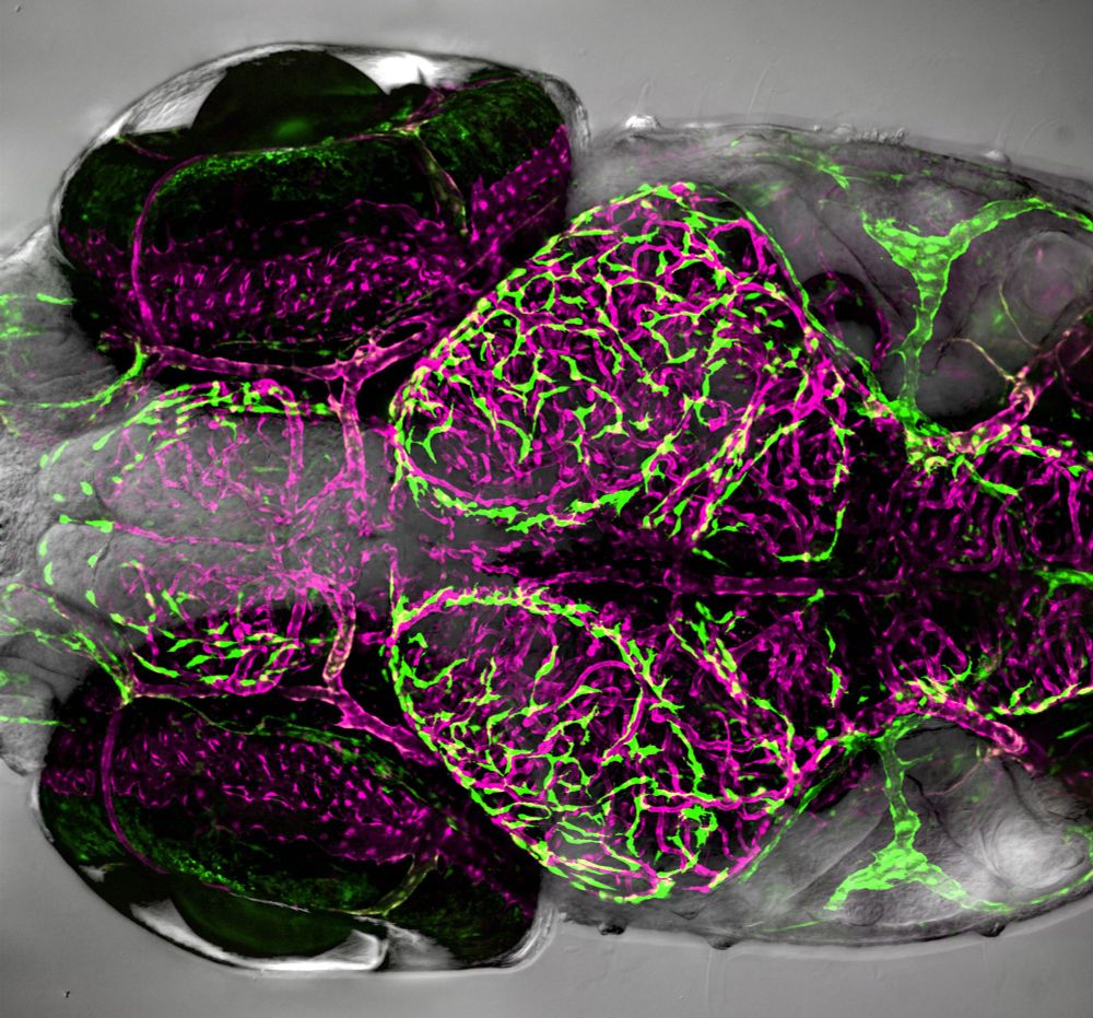 A highly detailed gray image of the dorsal view of a zebrafish head pointing to the left with two large black eyes on either side.  A complex network of magenta blood vessels look like tangled spaghetti in the center (brain region) of the image.  There are dozens of ameba-shaped green cells around the brain blood vessels and a few well-defined green lymphatic vessels on either side of the head.  Protruding from the skin on each side of the head, to the right (posterior) to the eye, there are three volcano-like structures with long, transparent, hair-like projections.  These are hair cells that the fish uses to sense changes in water flow.  