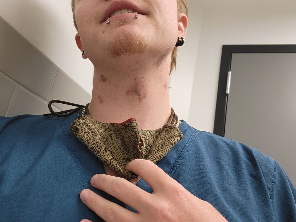 A shot of Blue from his chest to his nose. There are five visible hickeys on his neck.