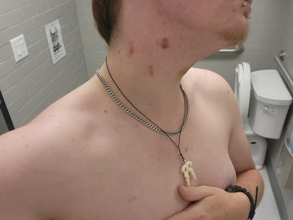 A 3/4 shot of Blue from his chest to his cheek. He's wearing a bone pendant, a stainless steel miami cuban chain, and has four visible hickeys on the left side of his neck