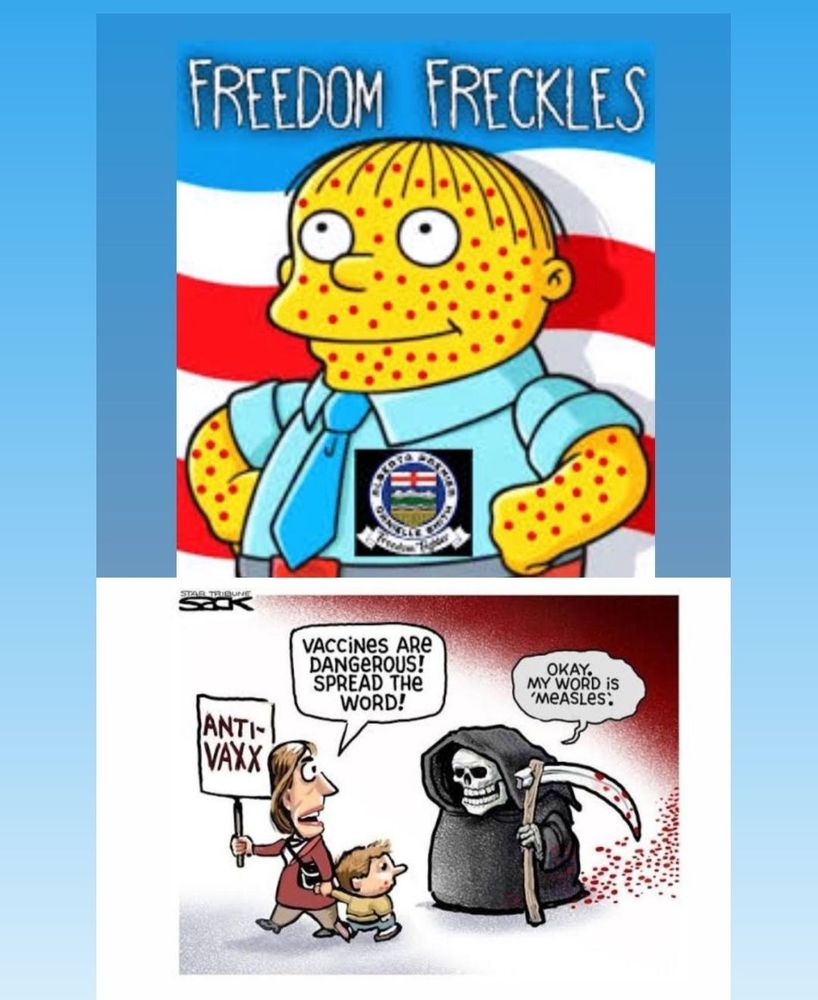 Split meme:
On top, a young male character from the Simpsons, covered in measles, standing in front of red and white stripes. Text above him reads, "Freedom Freckles"
Bottom frame:
Cartoon image of an adult, holding an anti-vax sign, walking with a child, says, "Vaccines are dangerous! Spread the word!" to the Grim Reaper who replies, "Okay, my word is measles."
  
Canada just lost its measles-free status for the first time since 1998 — and experts say Alberta is to blame.

According to Dr. James Talbot, Alberta’s former Chief Medical Officer:

> “A lot of people worked for a long time to achieve that measles elimination status, and to lose it in one year because of a failure of government action… for a disease that’s totally preventable, it just makes me sad.”

Dr. Karina Top called it a “wake-up call,” saying it’s a collective failure in leadership, public health, and vaccination policy that worsened since COVID.
Dr. Sam Wong added Alberta “didn’t put enough resources” into early vaccination and “didn’t really see the seriousness of it.”

Meanwhile, Danielle Smith keeps parroting MAGA-style “freedom” rhetoric and flirting with conspiracy theories instead of listening to doctors and scientists.
And now? Alberta has more measles cases than the entire U.S.

This isn’t freedom. It’s failure — and kids are paying the price.

We need leaders who believe in science. And we need CBC to keep telling the truth when governments won’t.

38% of all Canadian measles cases came from Alberta
1,900+ infections, 154 hospitalizations, 15 ICU cases, 2 dead babies
Read the full CBC story:
https://r.pebmac.ca/.../alberta-measles-status...
