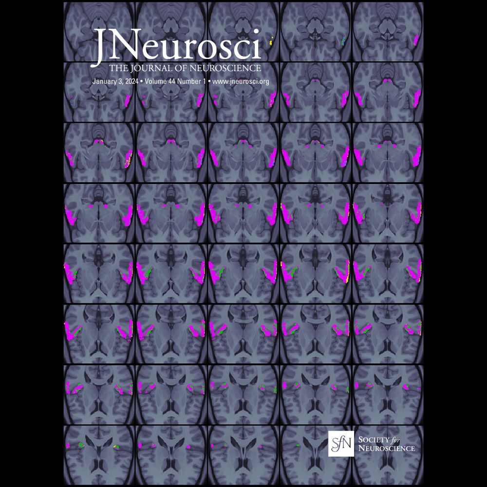 Memory Retrieval of Visuospatial Context is Supported by the Anterior Portions of High-Level Visual ...